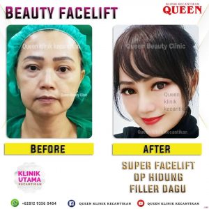 20-10-26-09-05-27-916_deco