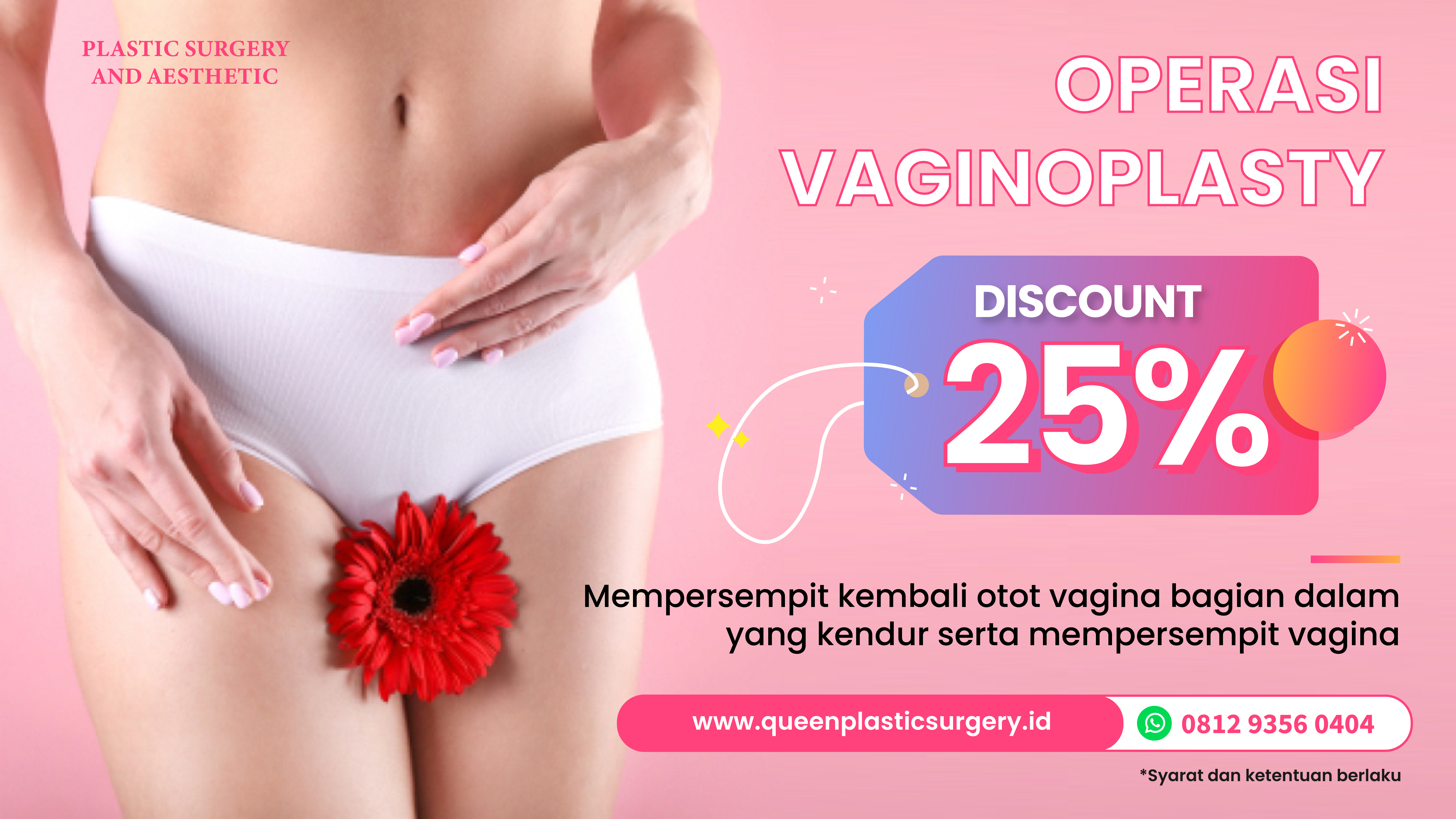 Vaginoplasty-01