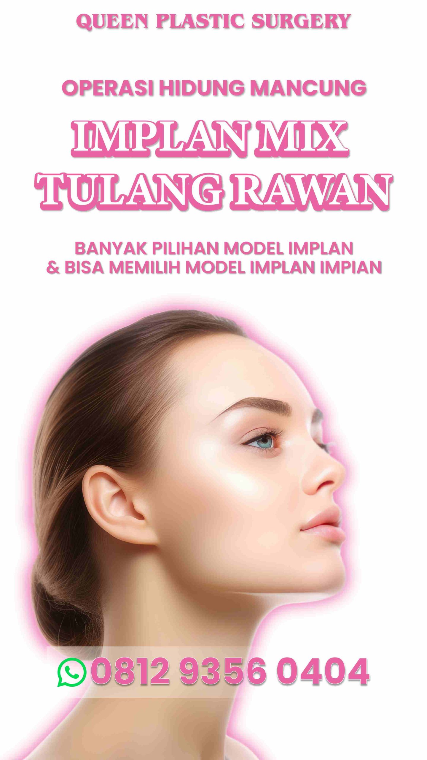 RHINOPLASTY MENGGUNAKAN TULANG RAWAN TERBAIK DI KLINIK KECANTIKAN QUEEN PLASTIC SURGERY