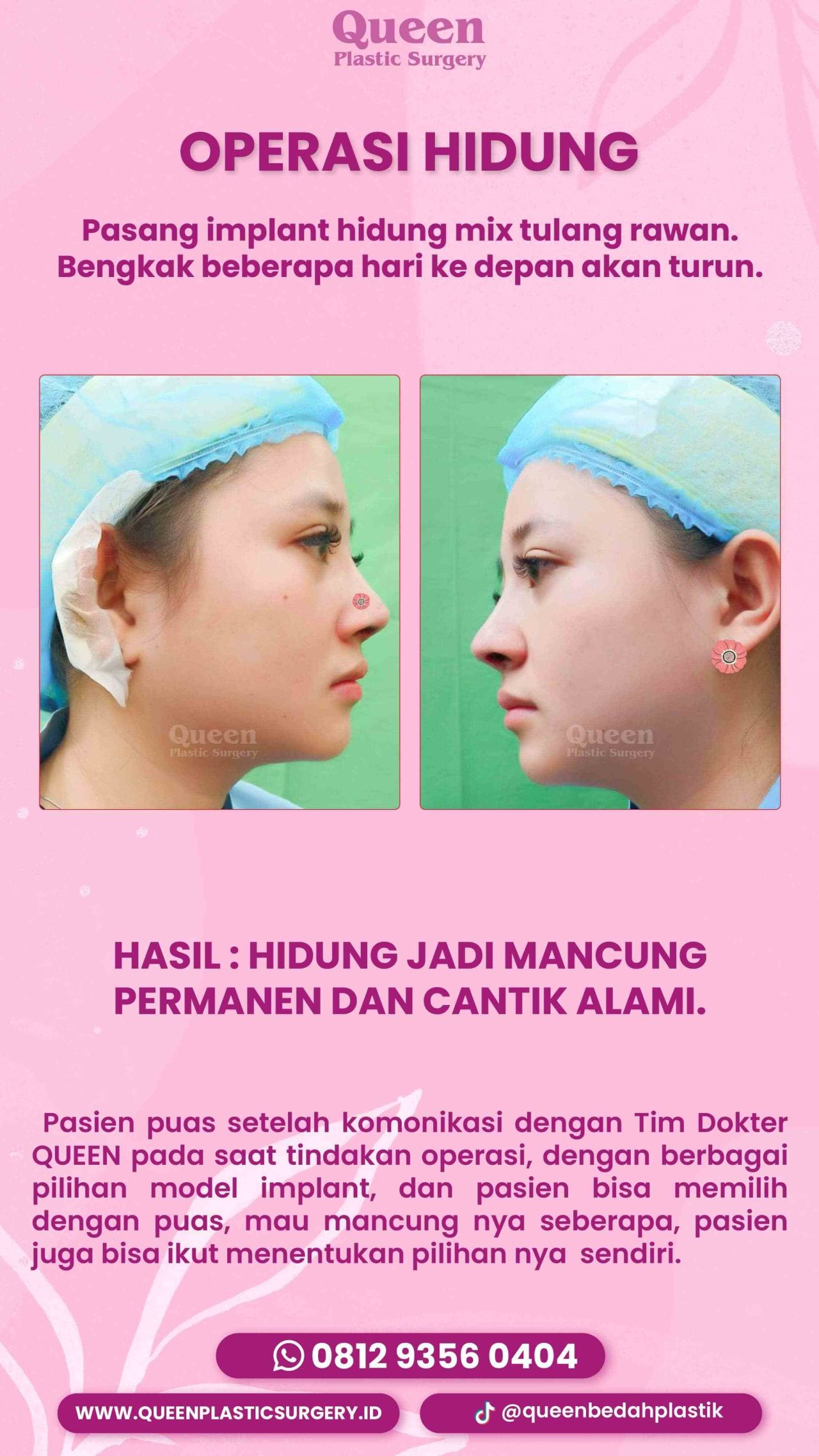 1 IGS 3723-fotor-2024013013239