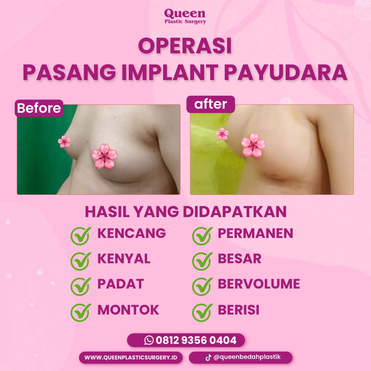 10 IGF