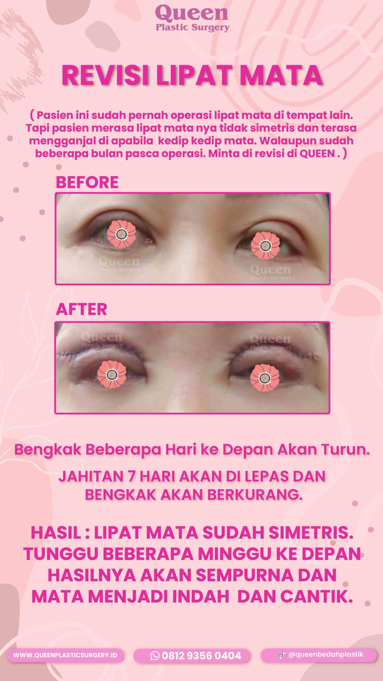 101 IGS-fotor-20240130114258