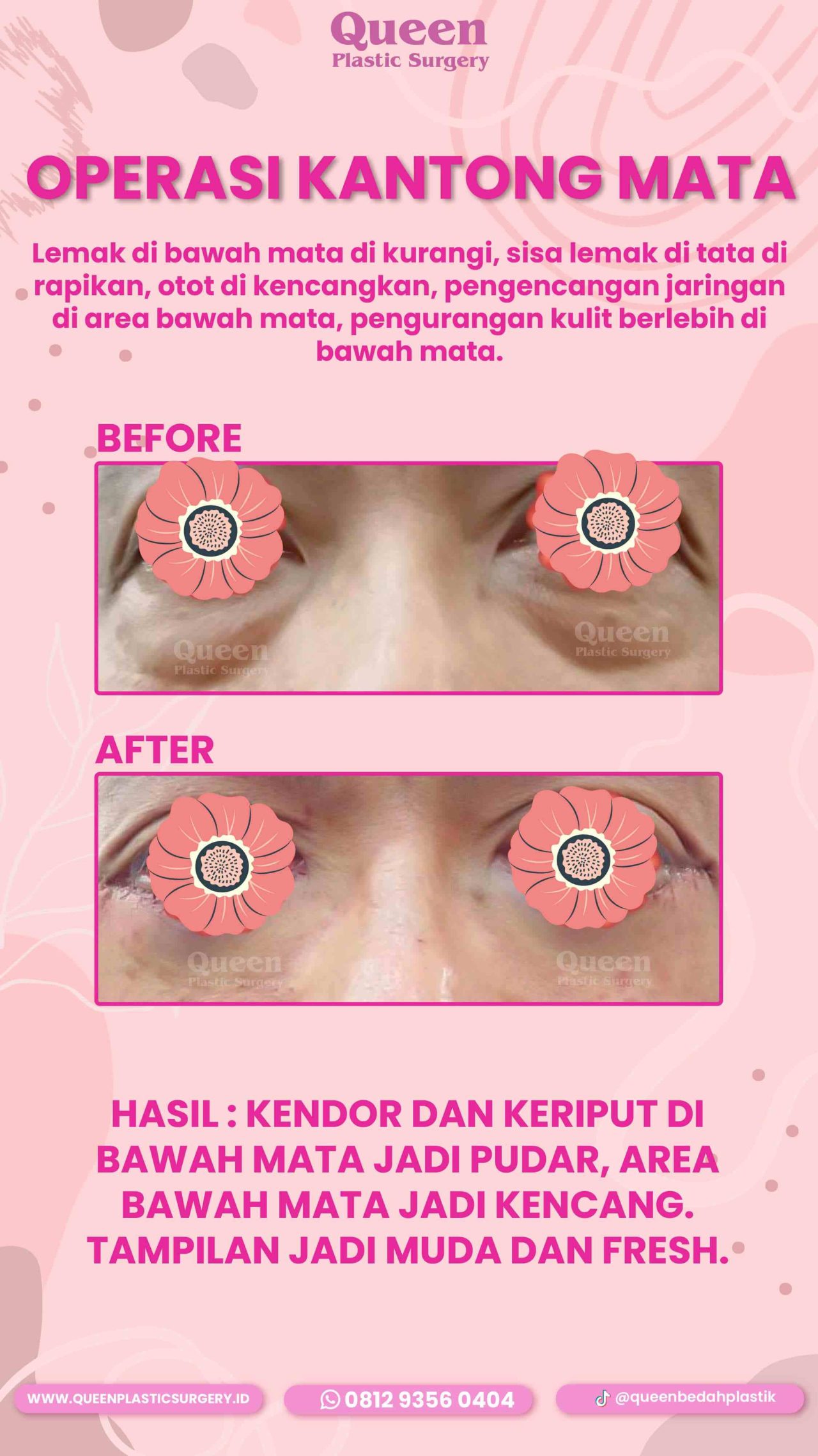 102 IGS-fotor-2024013011438