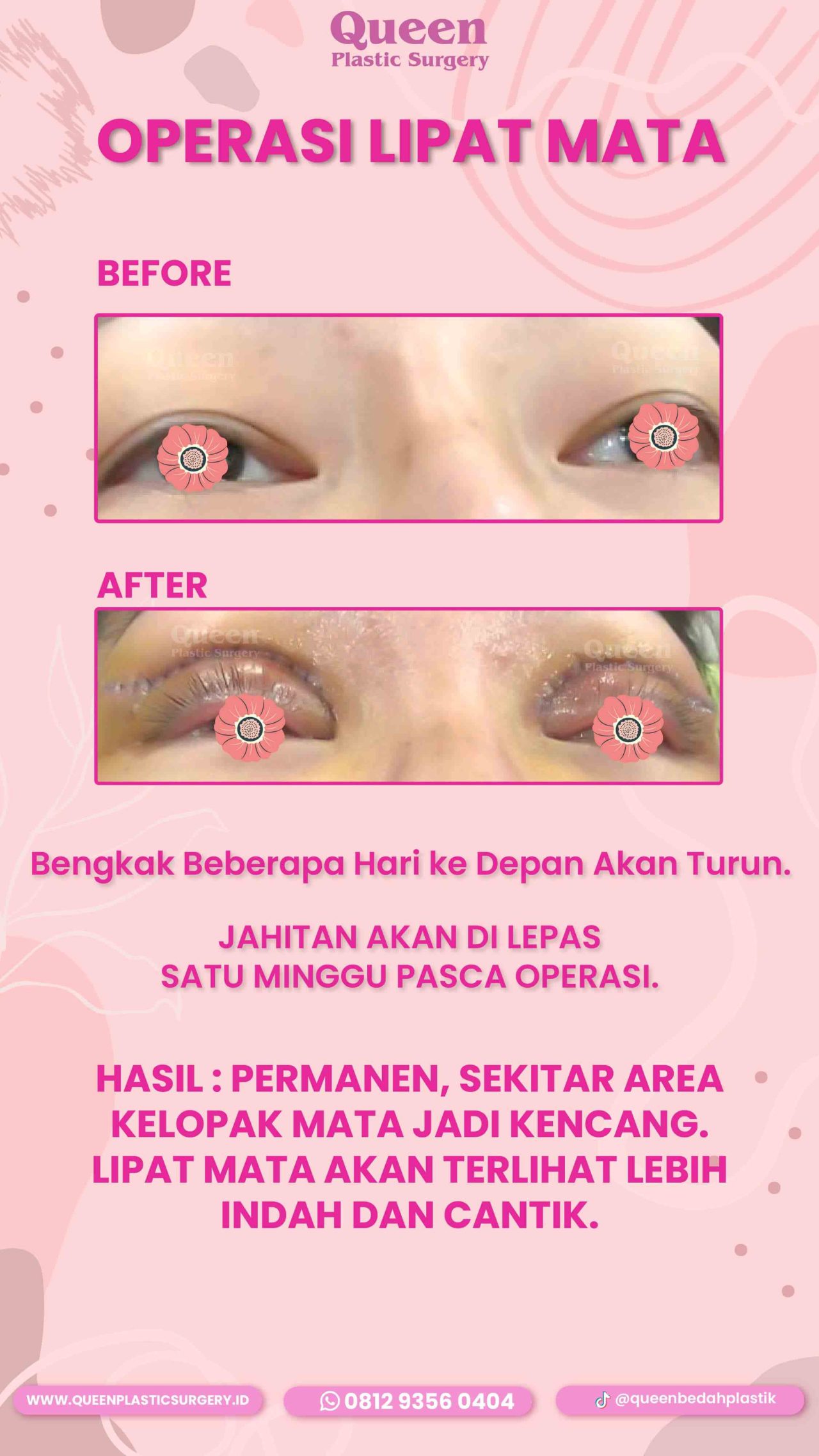 103 IGS-fotor-20240130114328