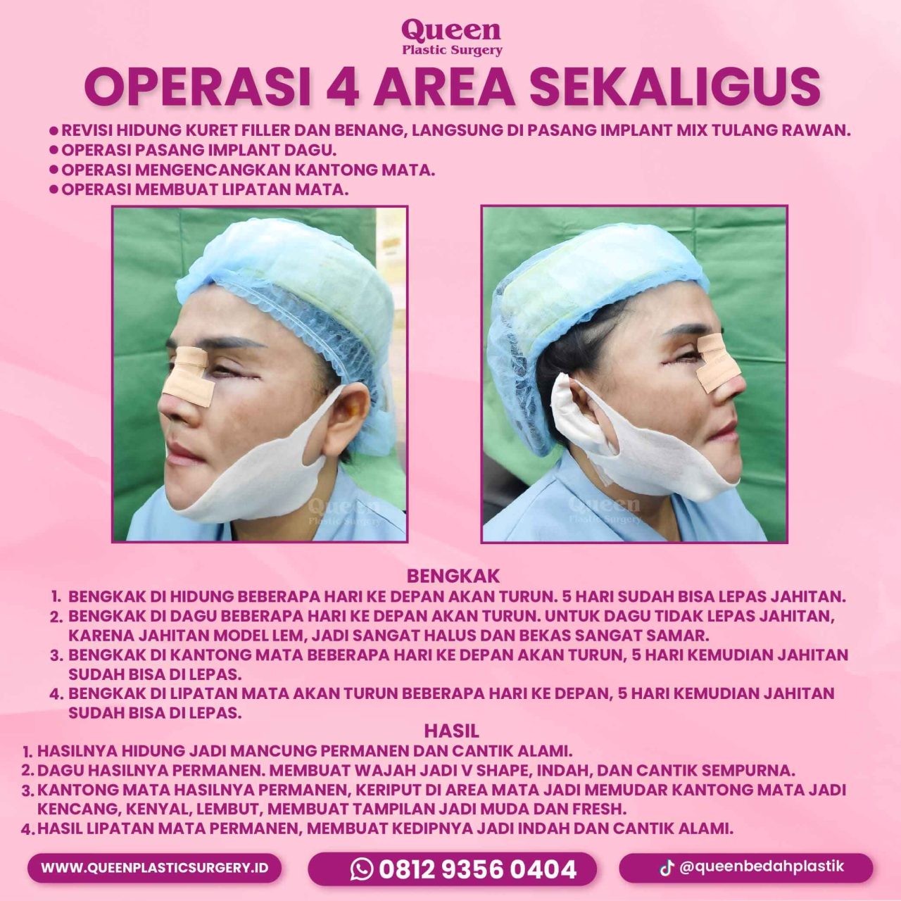 107 IGF 19723-fotor-20240130114341