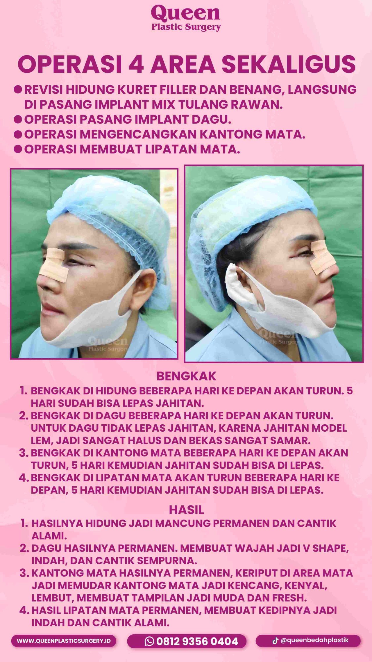 111 IGS -fotor-20240130113822