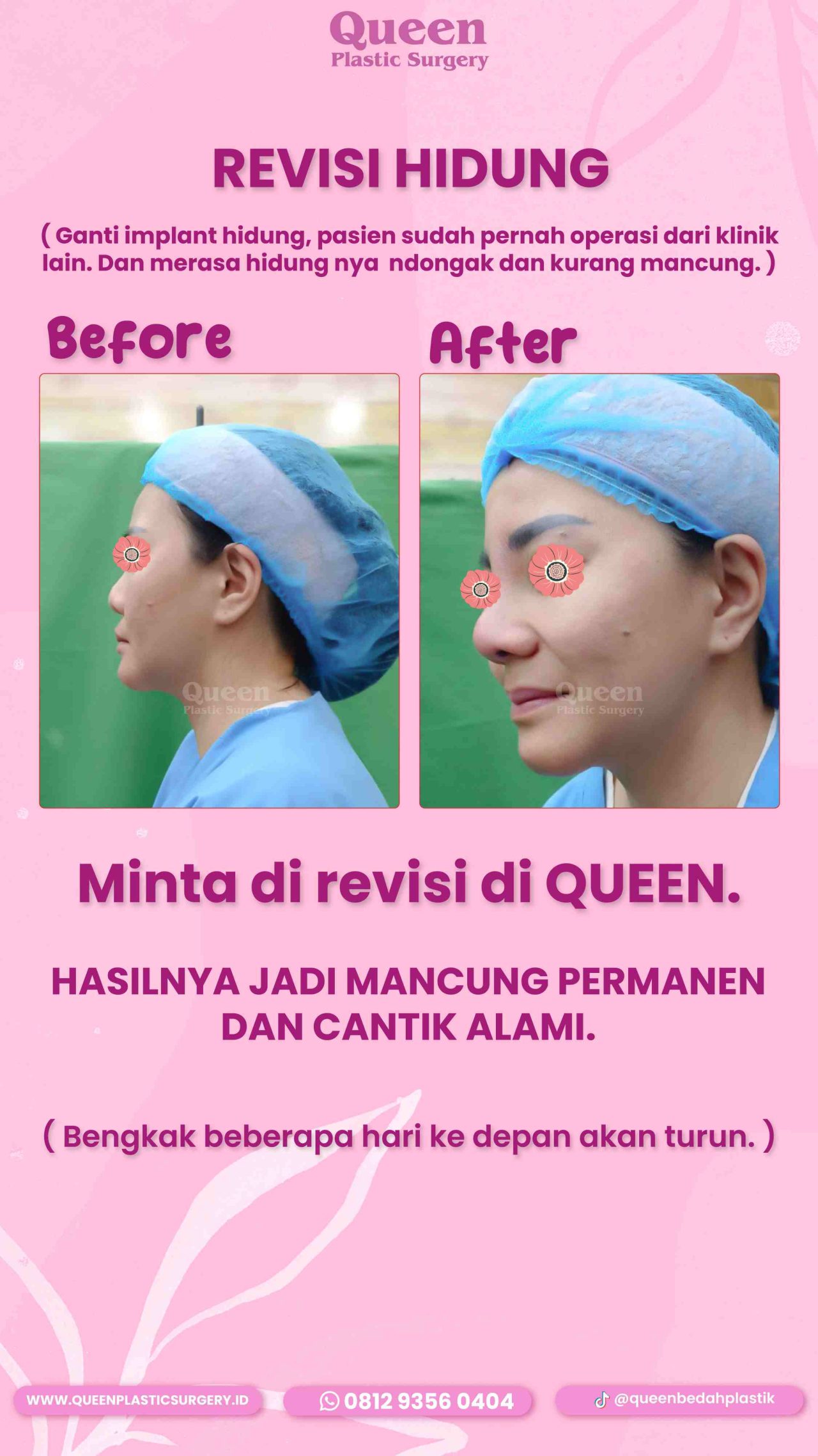 15 IGS-fotor-2024012915227