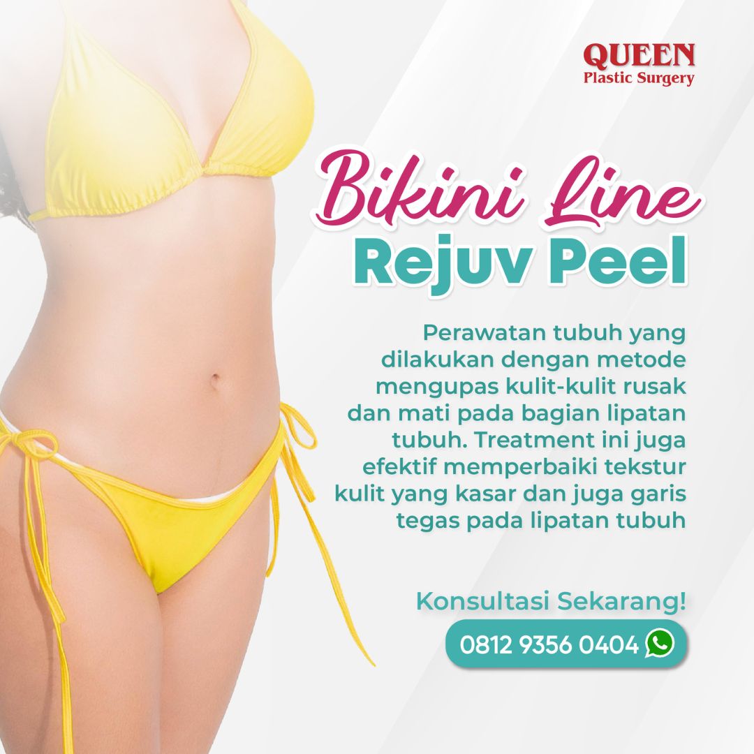 https://queenplasticsurgery.id/wp-content/uploads/2024/01/16-1.jpg