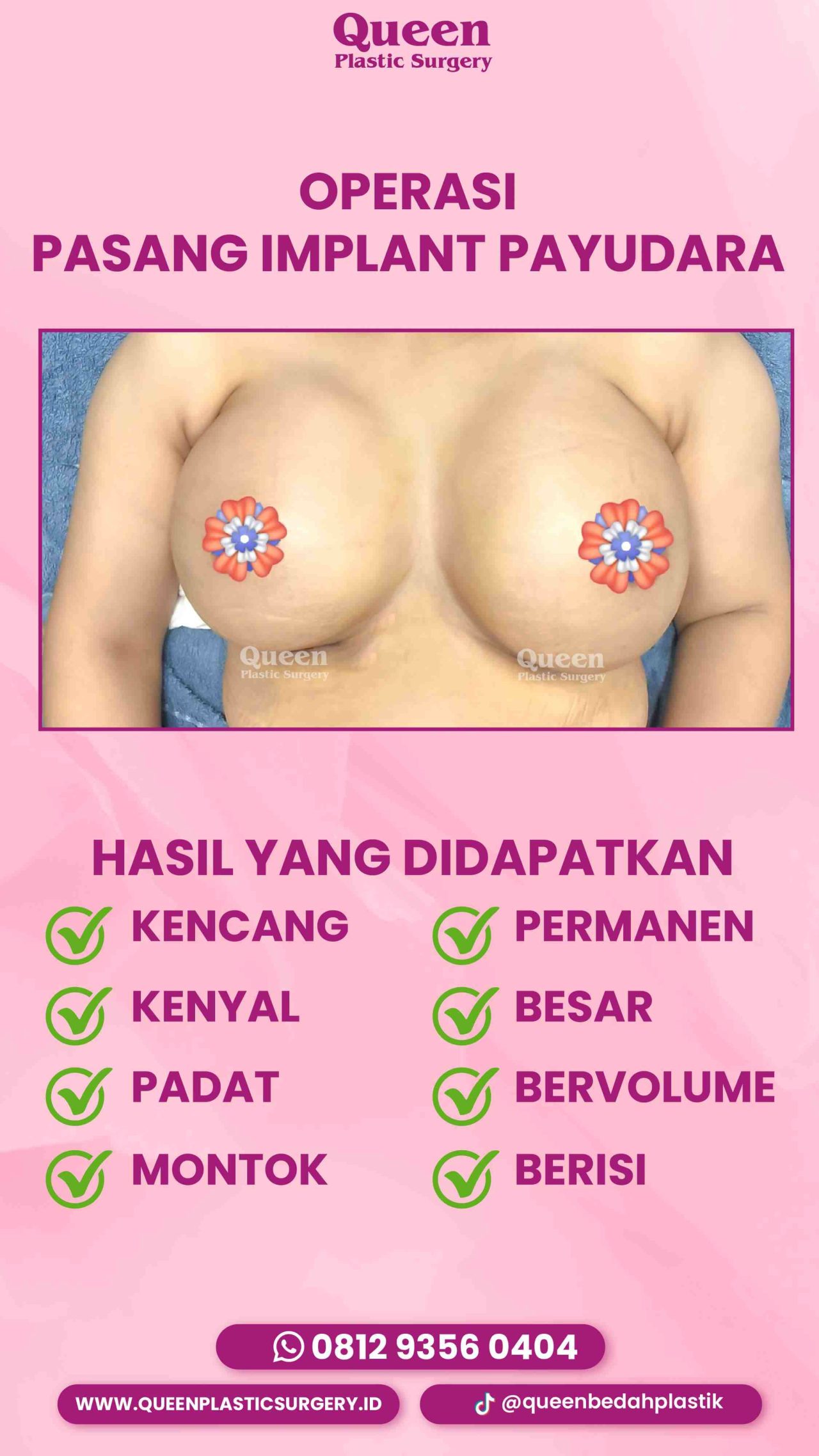 178 IGS-fotor-20240129162626