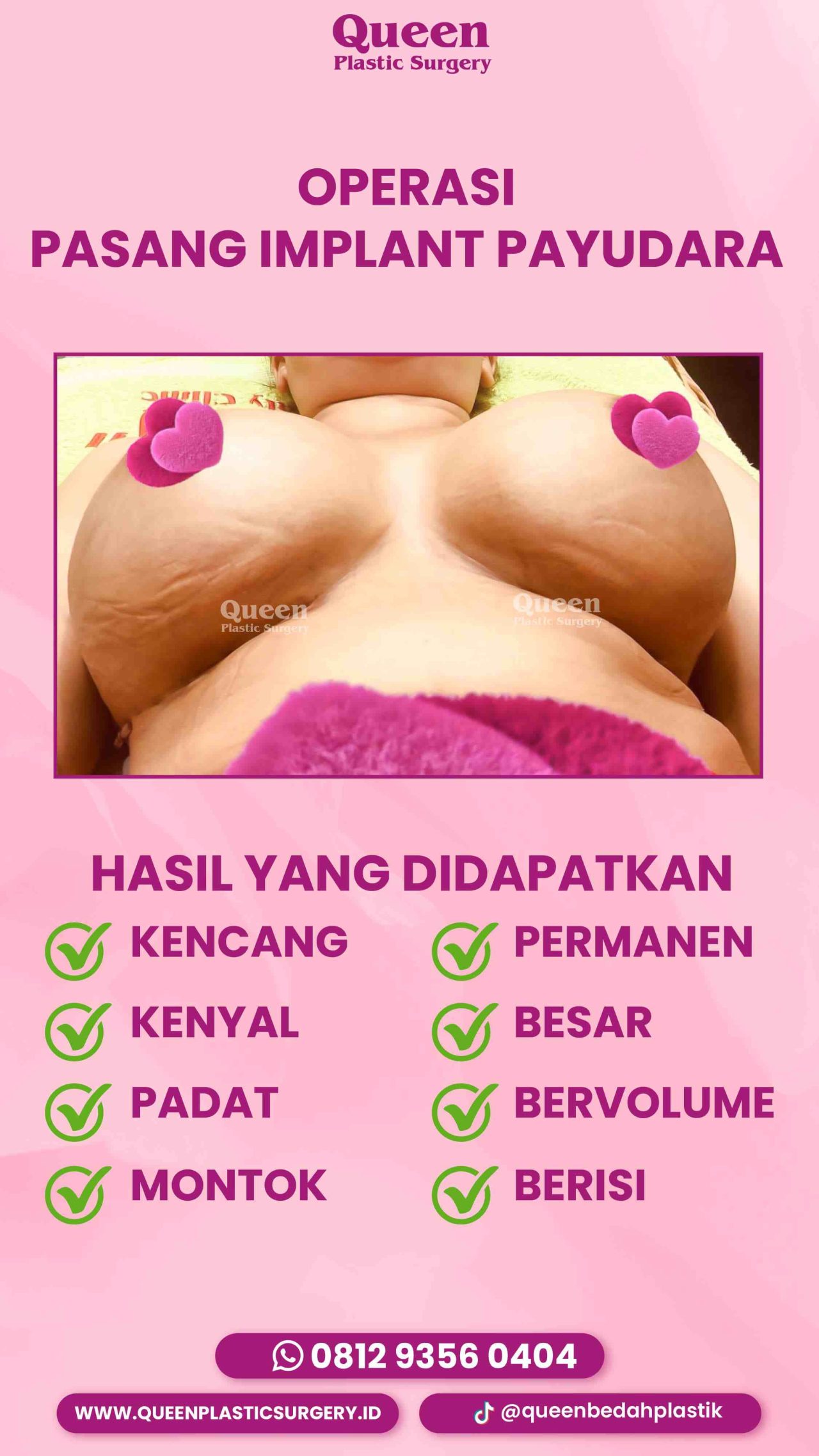 182 IGS -fotor-20240129163150