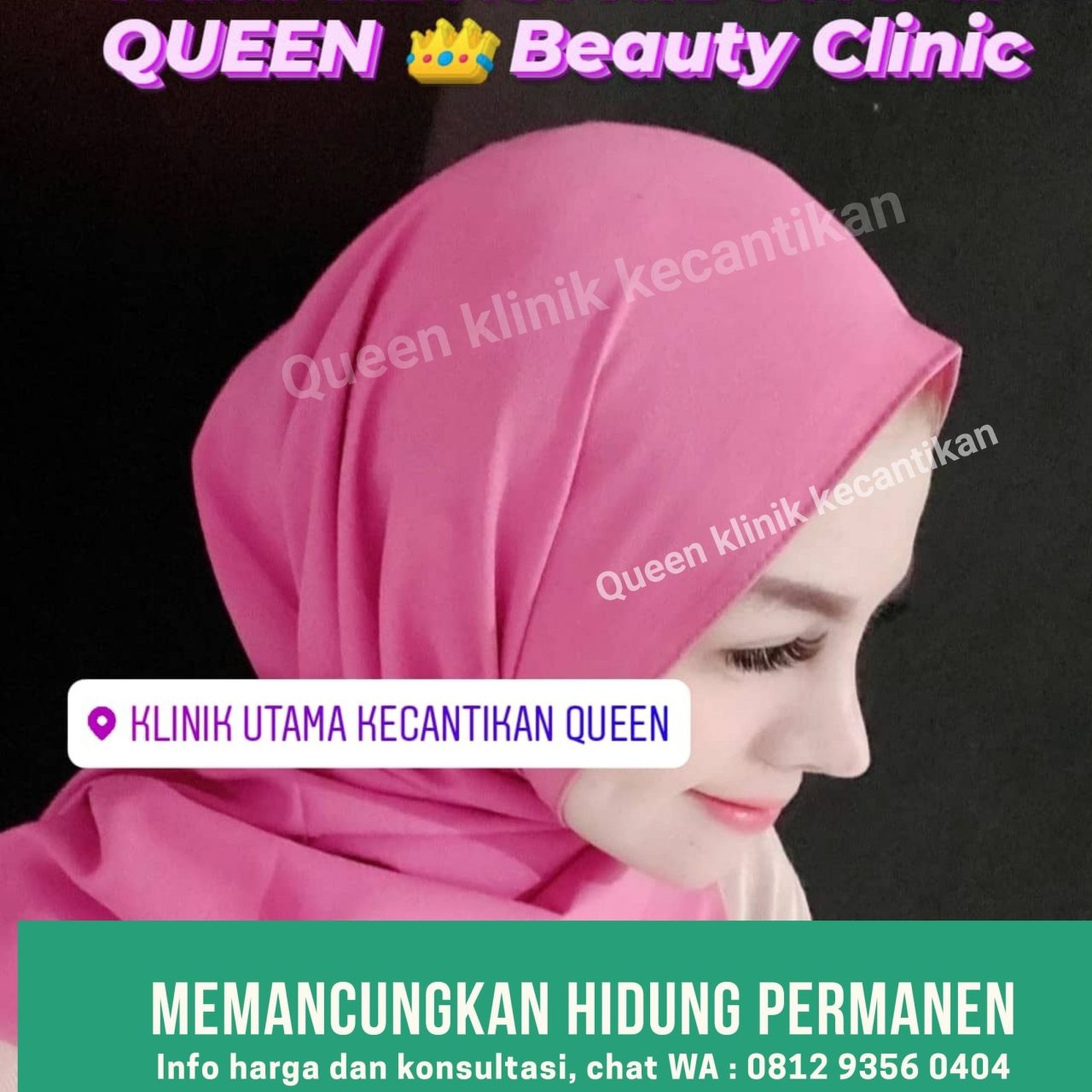 Hasil Rhinoplasty Queen Plastic Surgery, foto 74