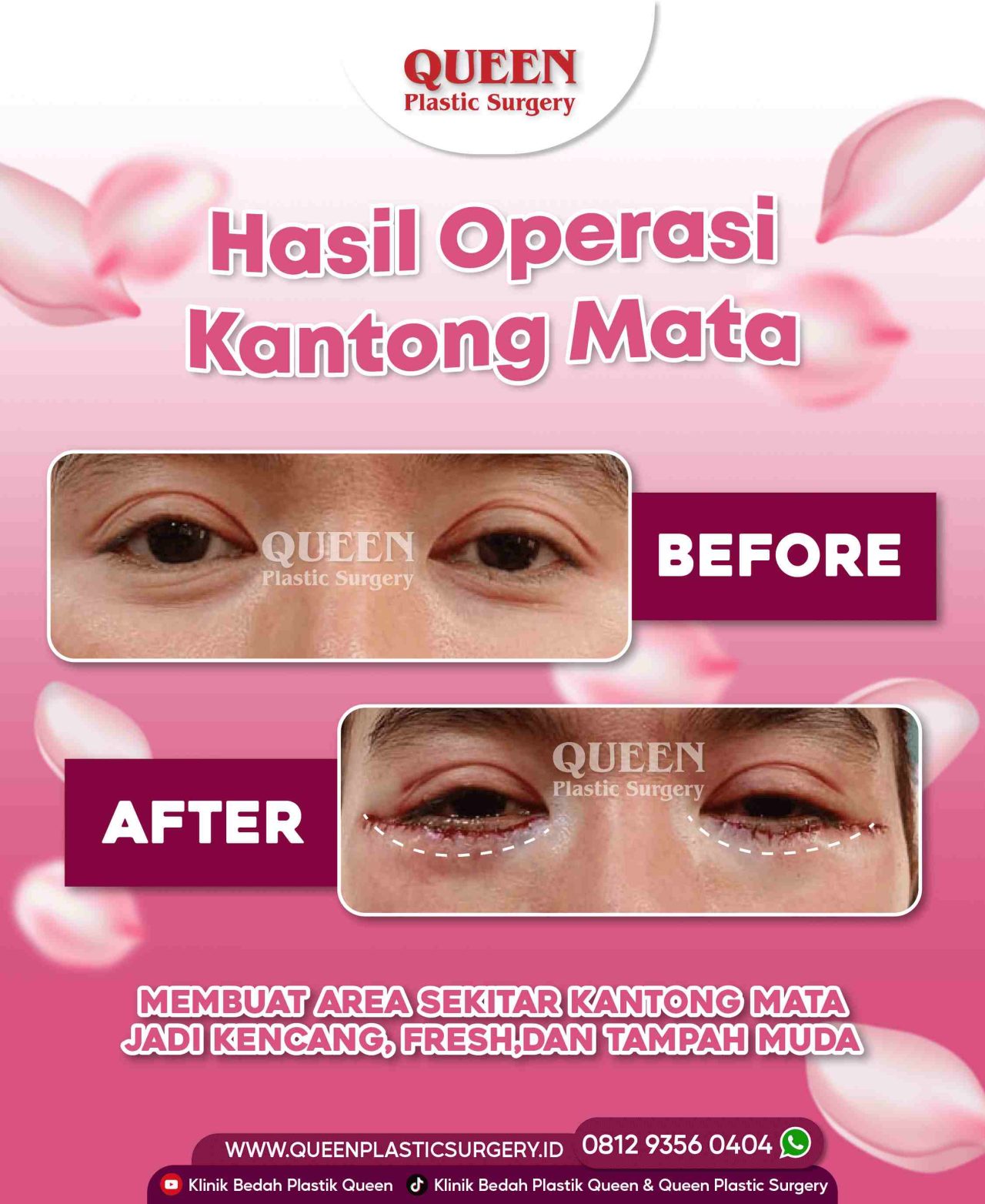 25 Agustus 2022-01 (1)-fotor-20240130112154