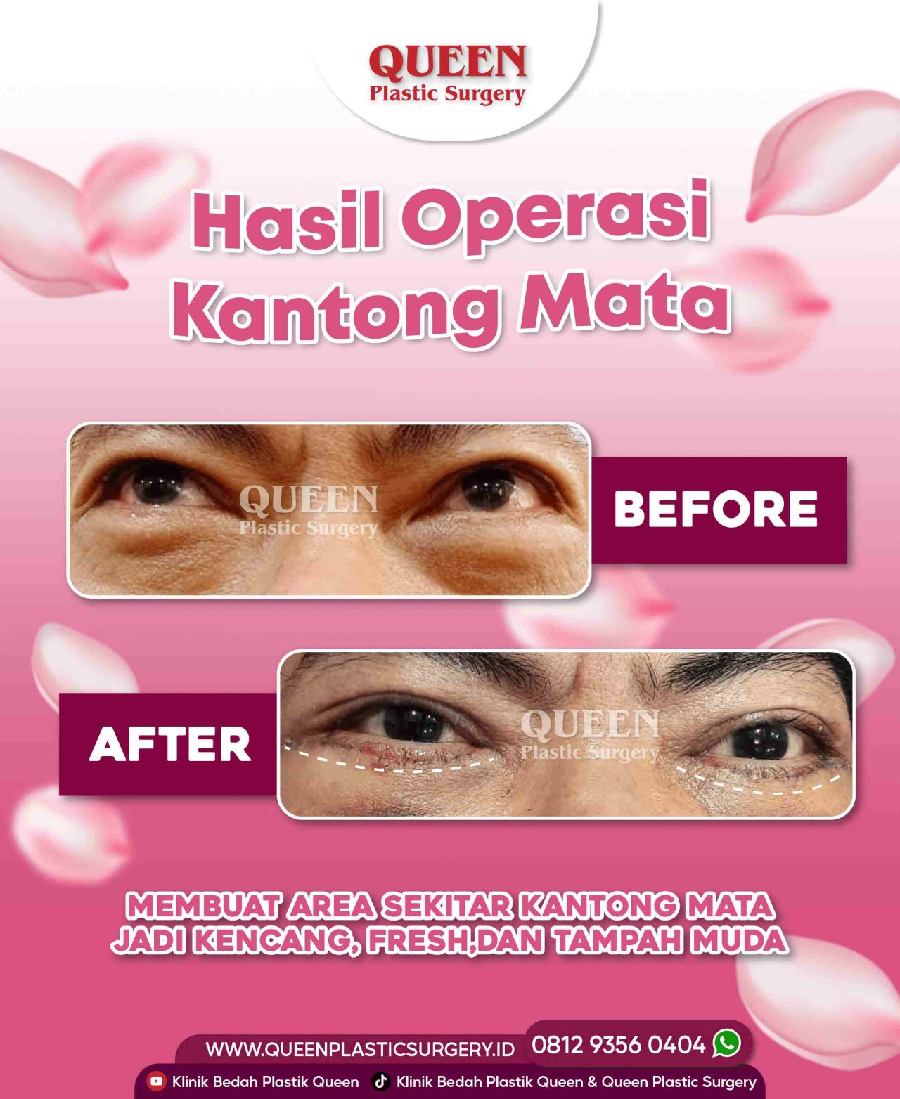 25 Agustus 2022-02 (1)-fotor-2024013011234