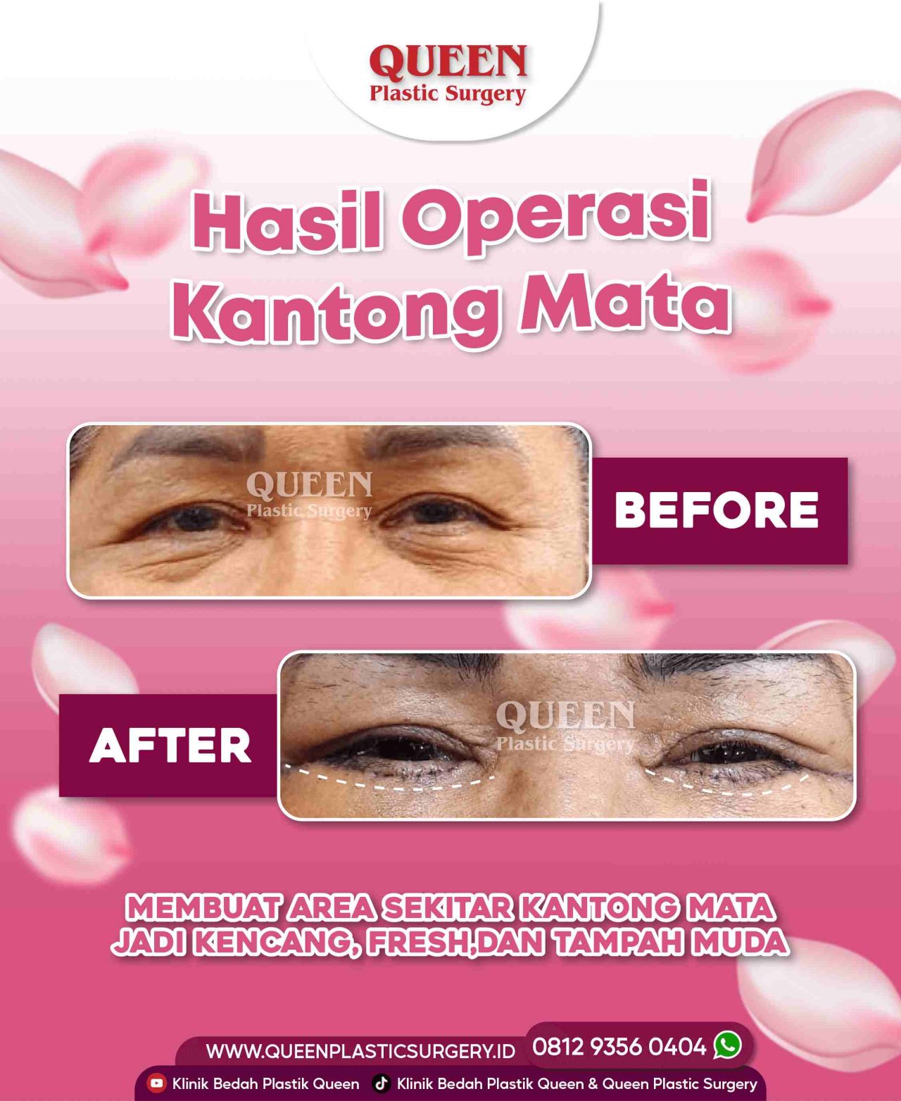 25 Agustus 2022-03 (1)-fotor-20240130112224