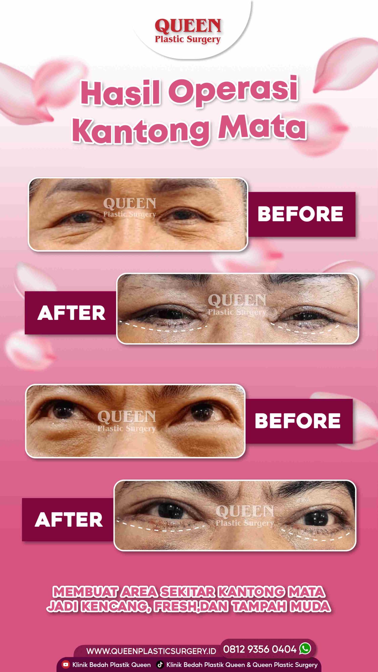 25 Agustus 2022-04 (1)-fotor-20240130112032