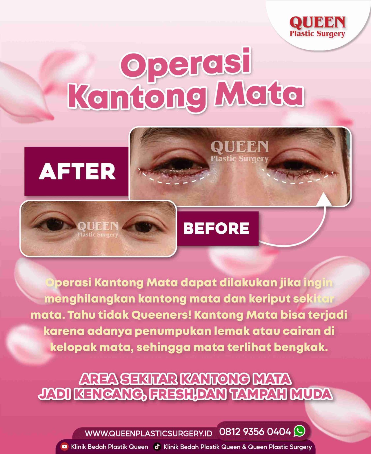 25 Agustus 2022-06 (1)-fotor-20240130112050