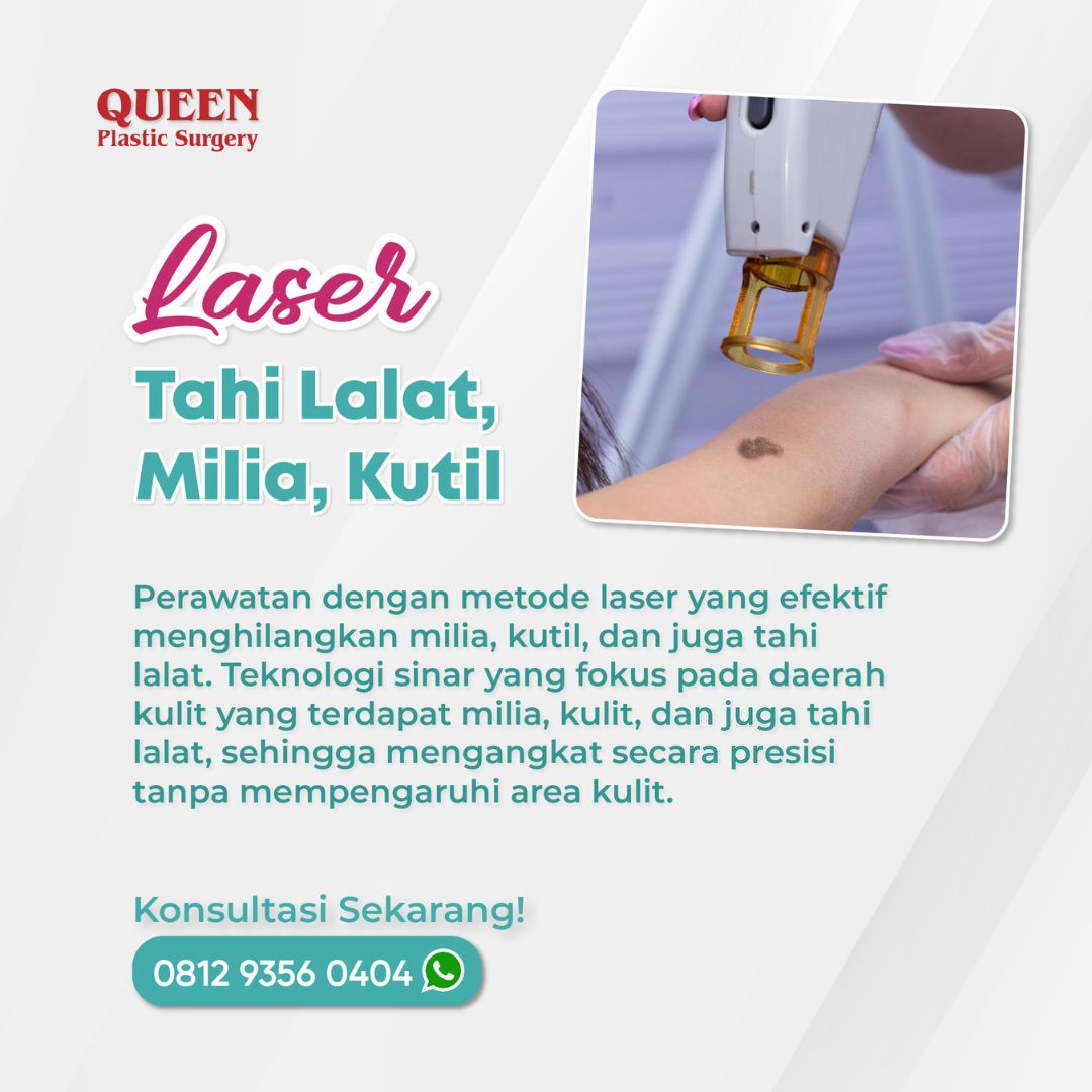 29 https://queenplasticsurgery.id/wp-content/uploads/2024/01/29-1.jpg