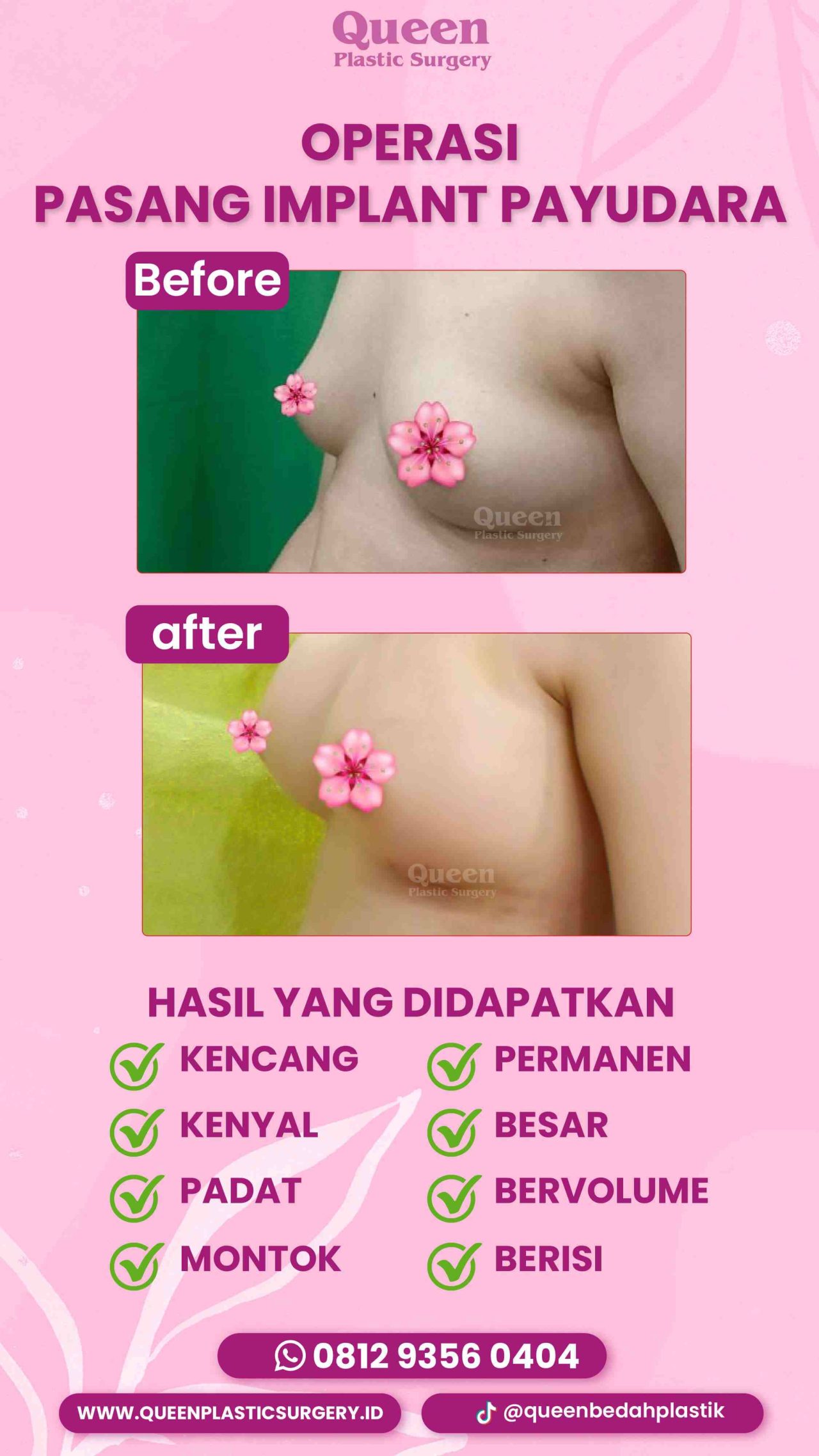 3 IGS -fotor-20240129163340