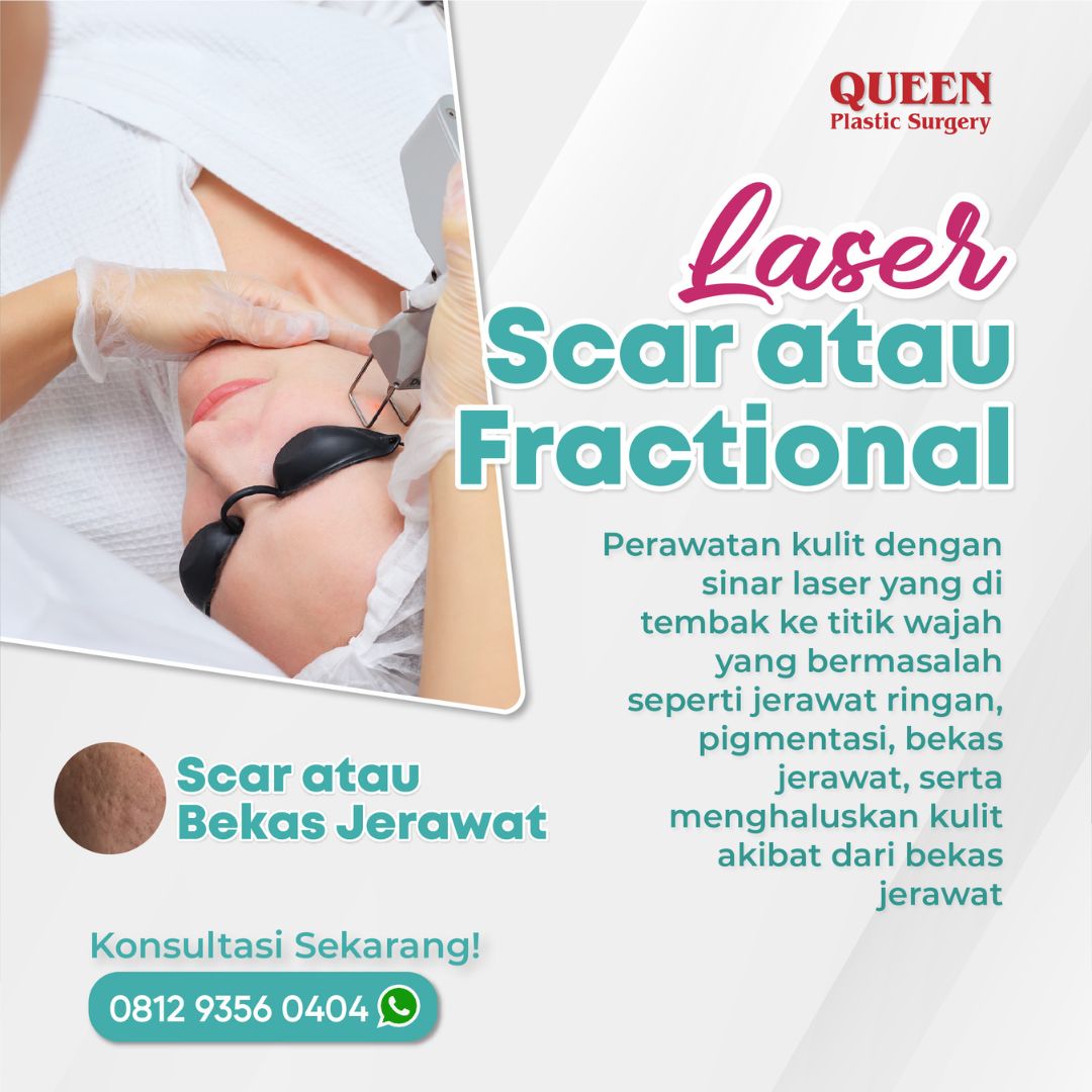 https://queenplasticsurgery.id/wp-content/uploads/2024/01/31-1.jpg