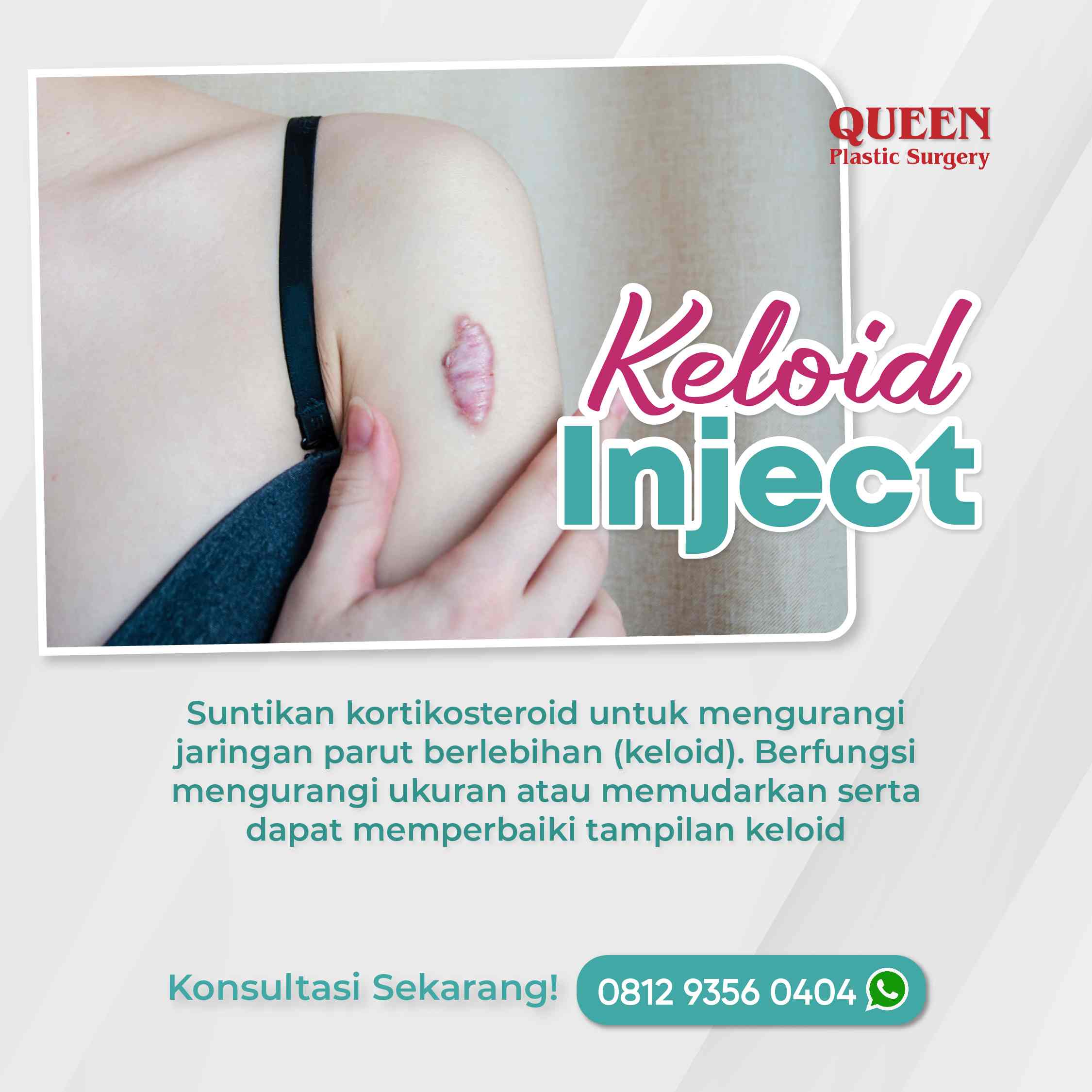https://queenplasticsurgery.id/wp-content/uploads/2024/01/31-Januari-07-fotor-2024013118431.jpg