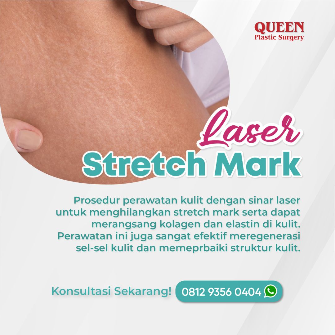 https://queenplasticsurgery.id/wp-content/uploads/2024/01/32-1.jpg