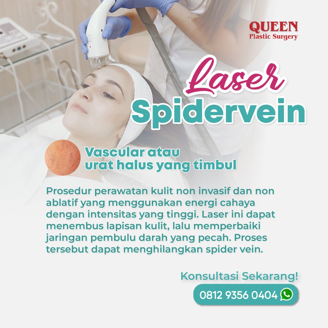 https://queenplasticsurgery.id/wp-content/uploads/2024/01/33-1.jpg