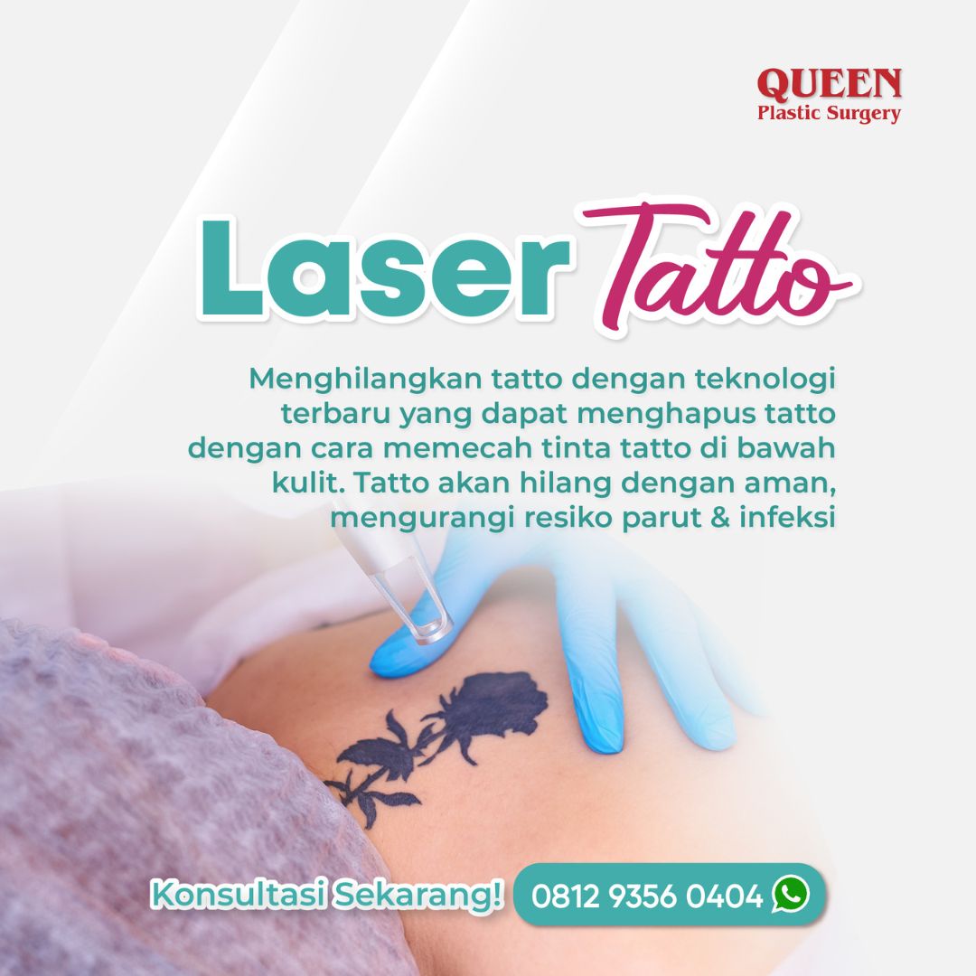 https://queenplasticsurgery.id/wp-content/uploads/2024/01/35-1.jpg