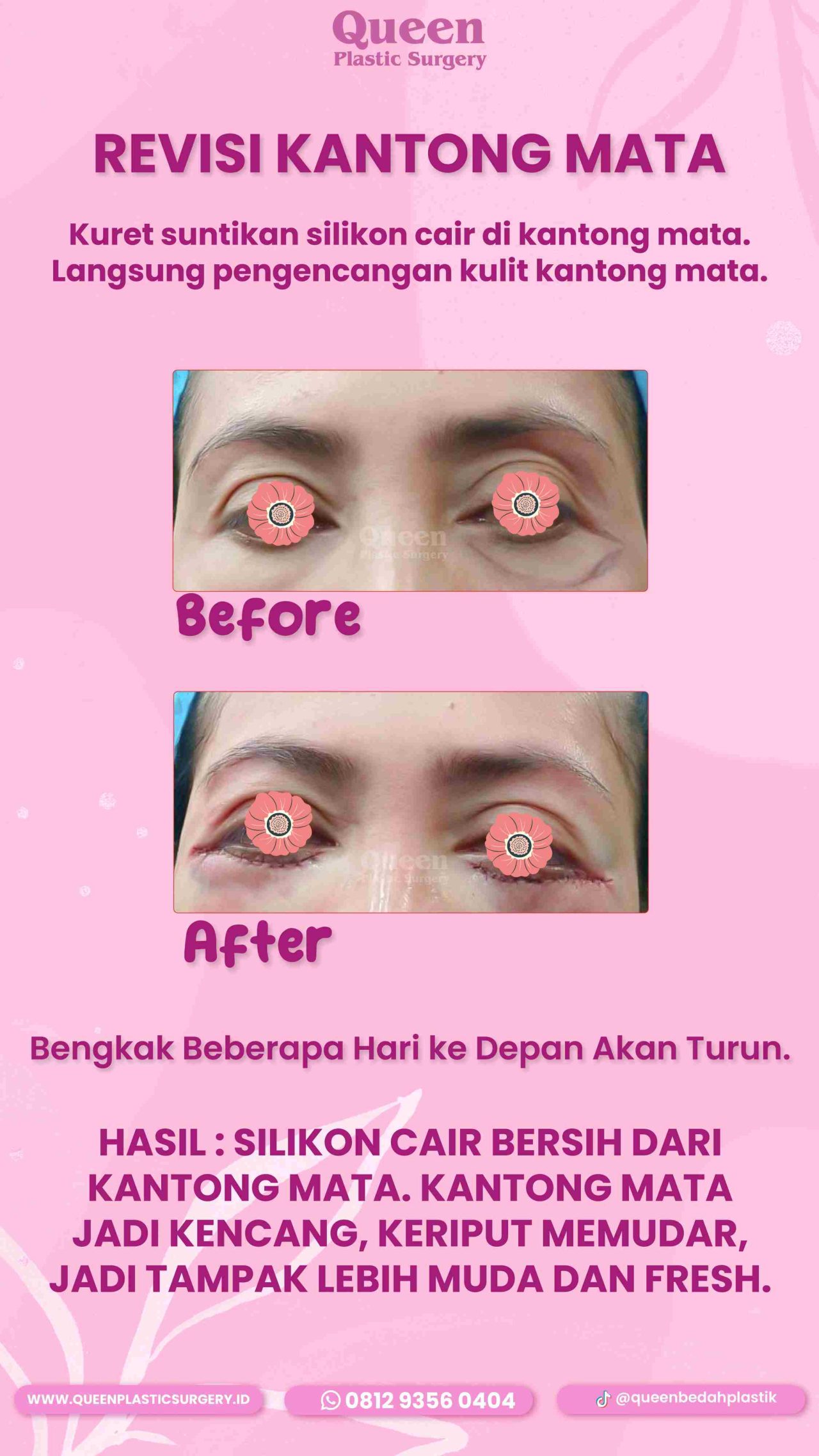 38 IGS-fotor-20240130112123