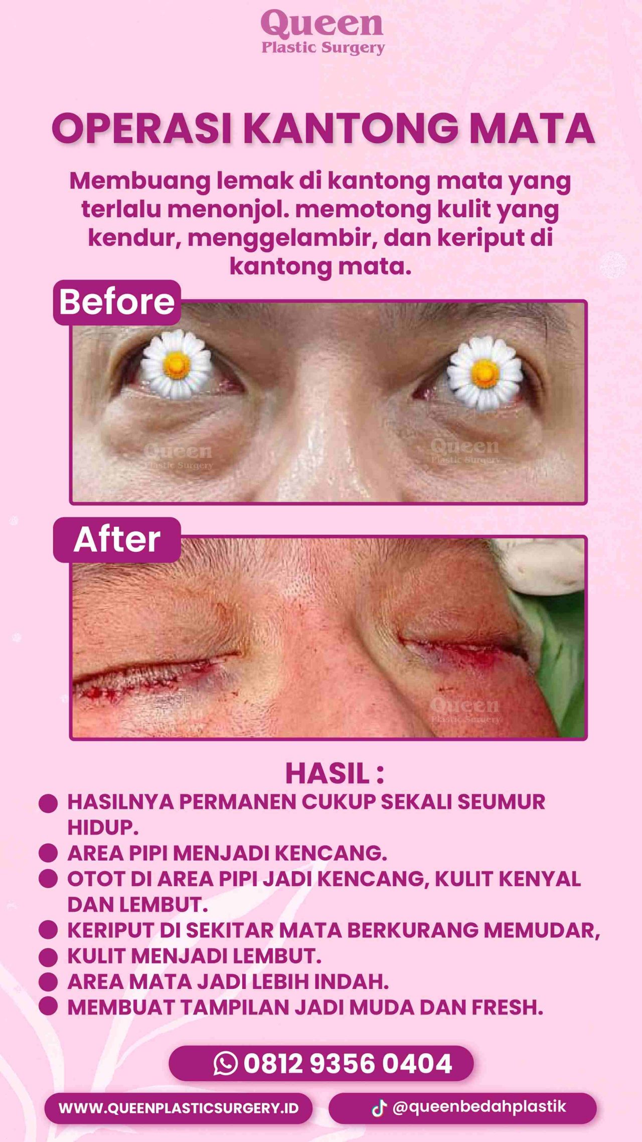 38 IGS -fotor-20240130112426