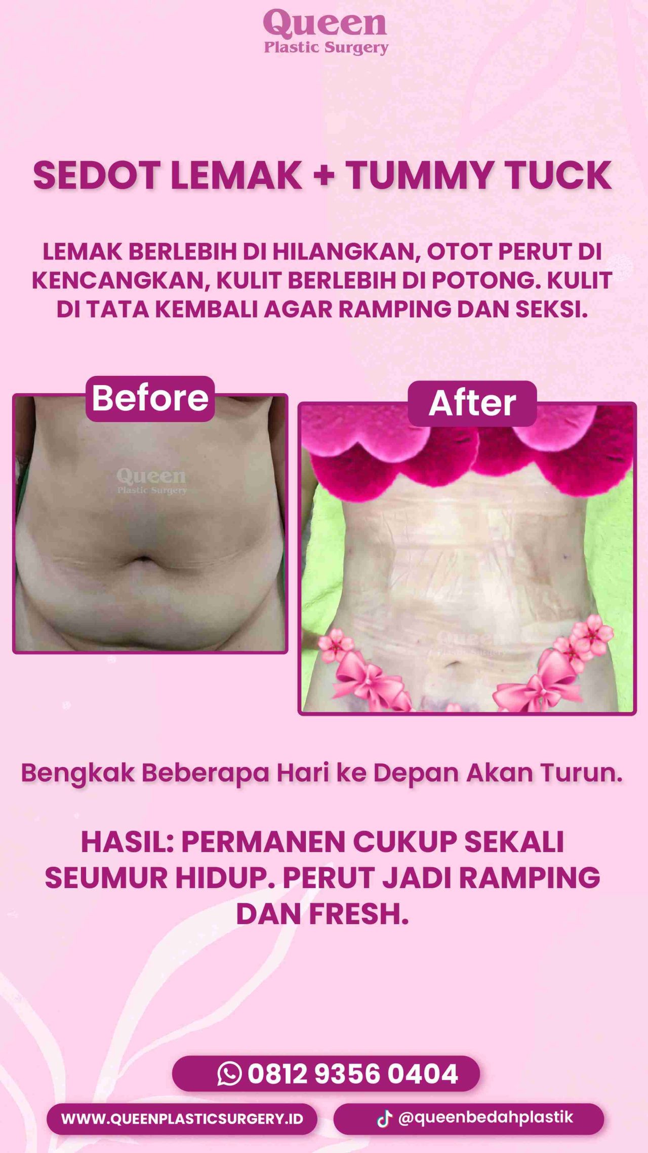 39 IGS -fotor-20240129141113
