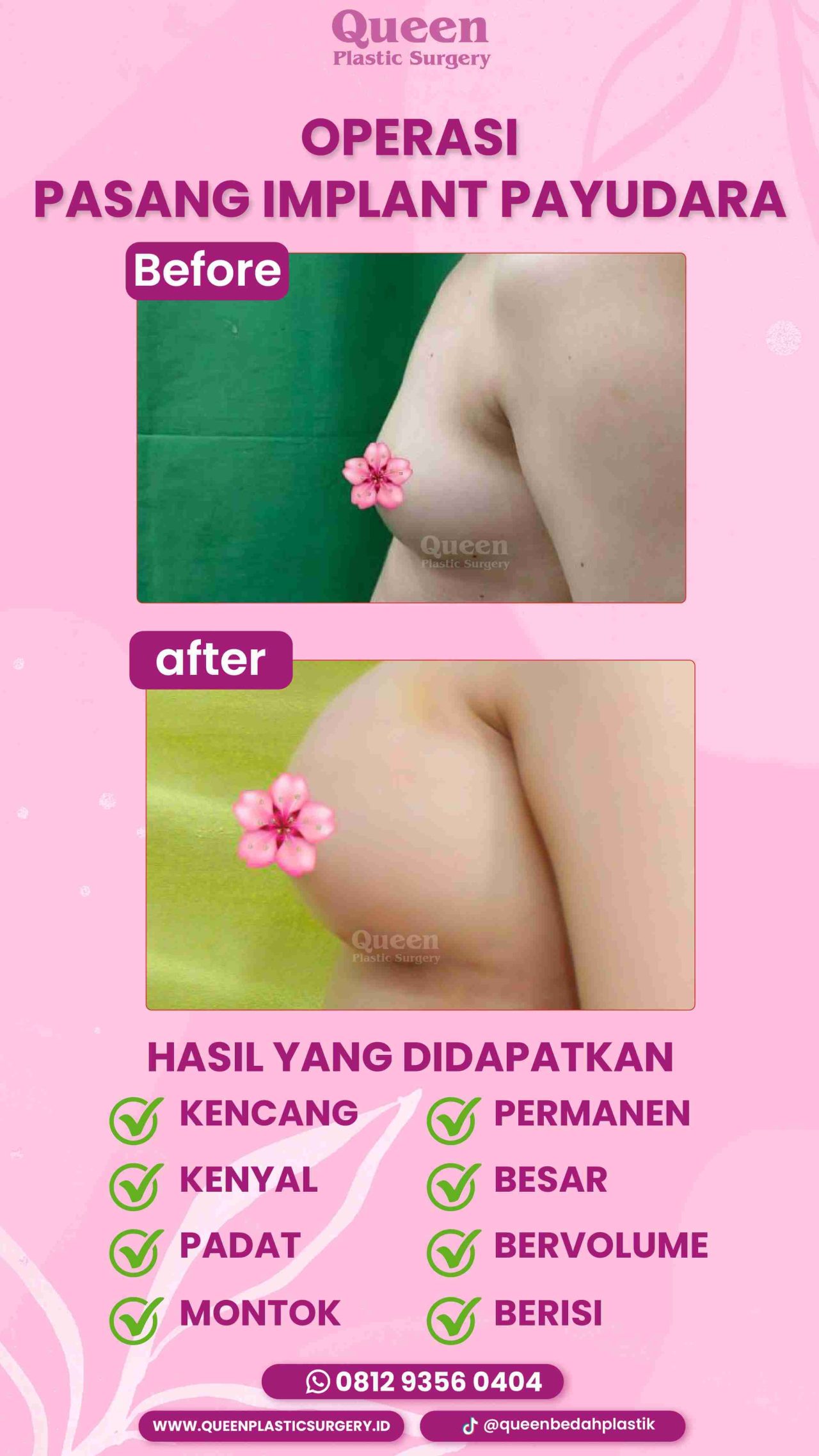 4 IGS -fotor-20240129163327