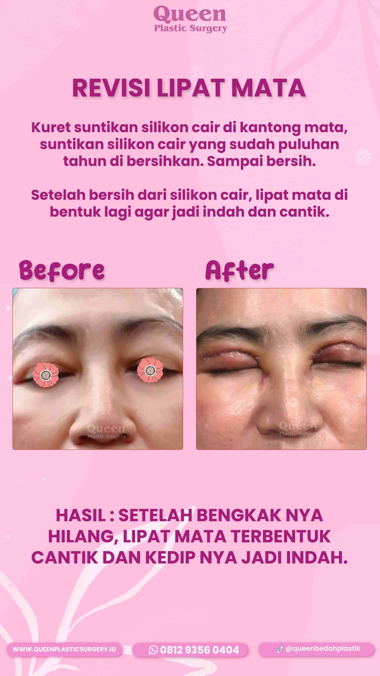 40 IGS-fotor-20240130112237