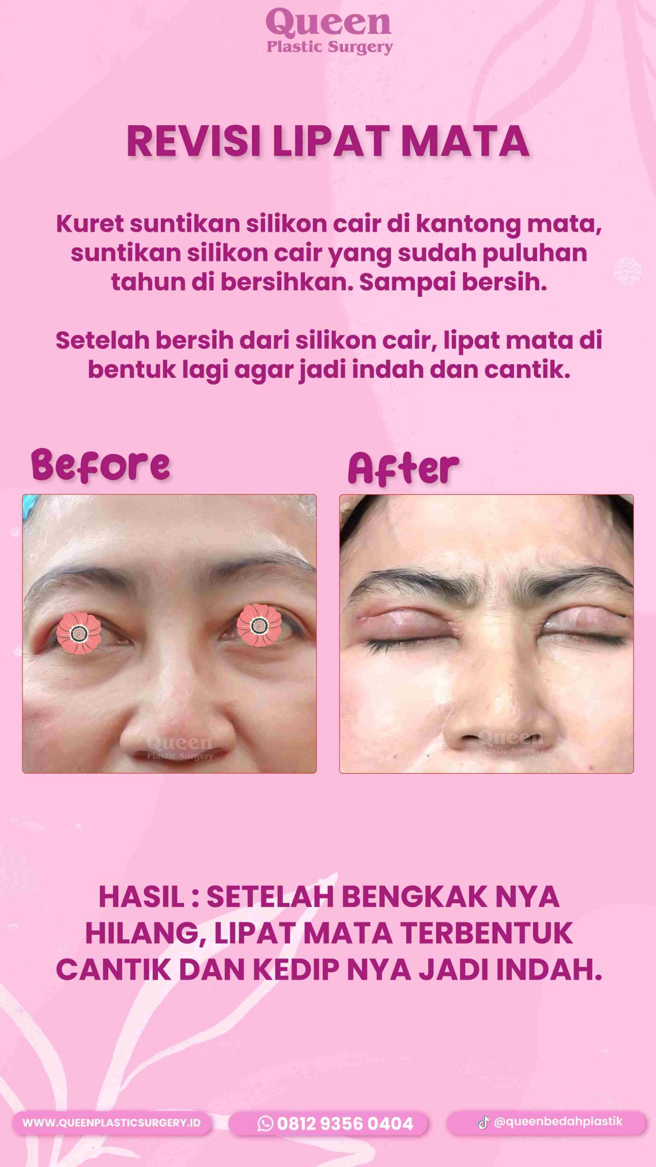 41 IGS-fotor-20240130112248