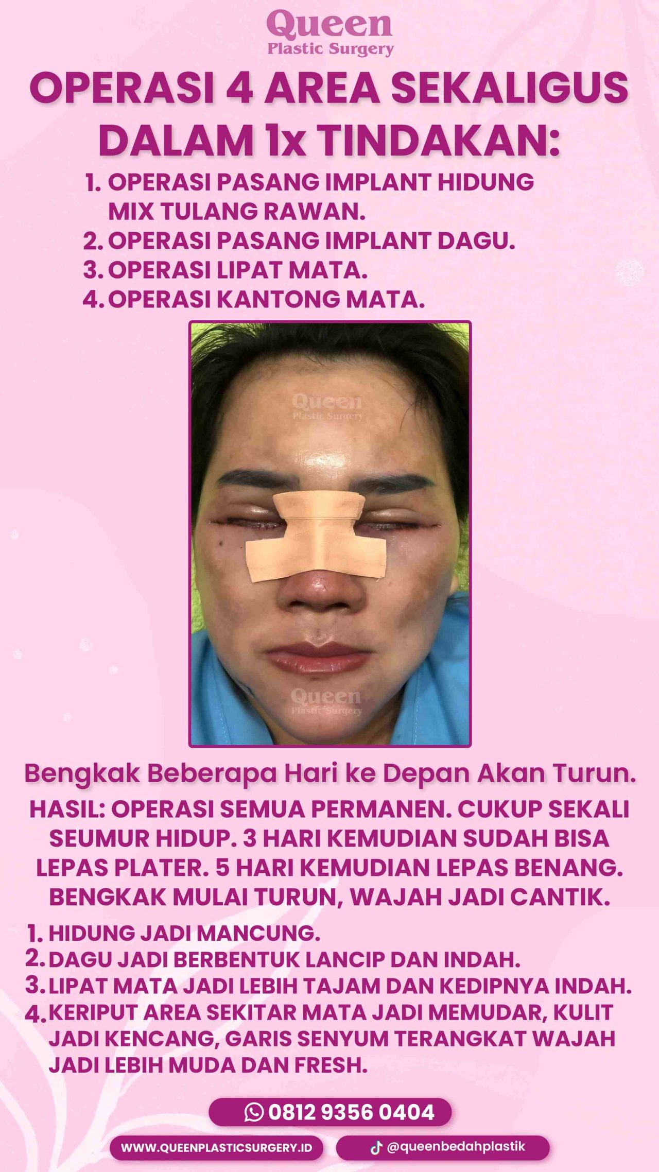 41 IGS -fotor-20240130114043