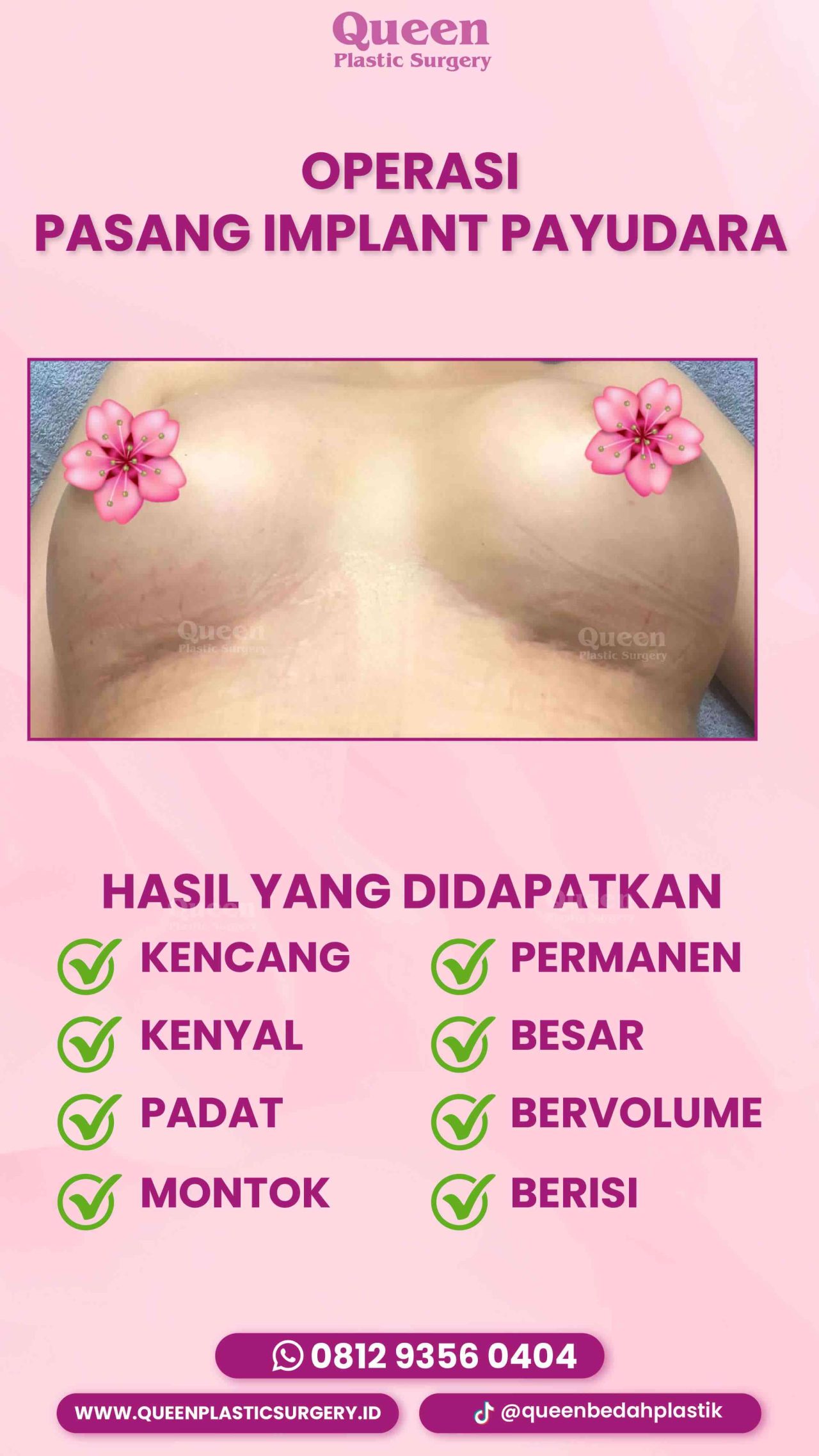 43 IGS -fotor-20240129163230