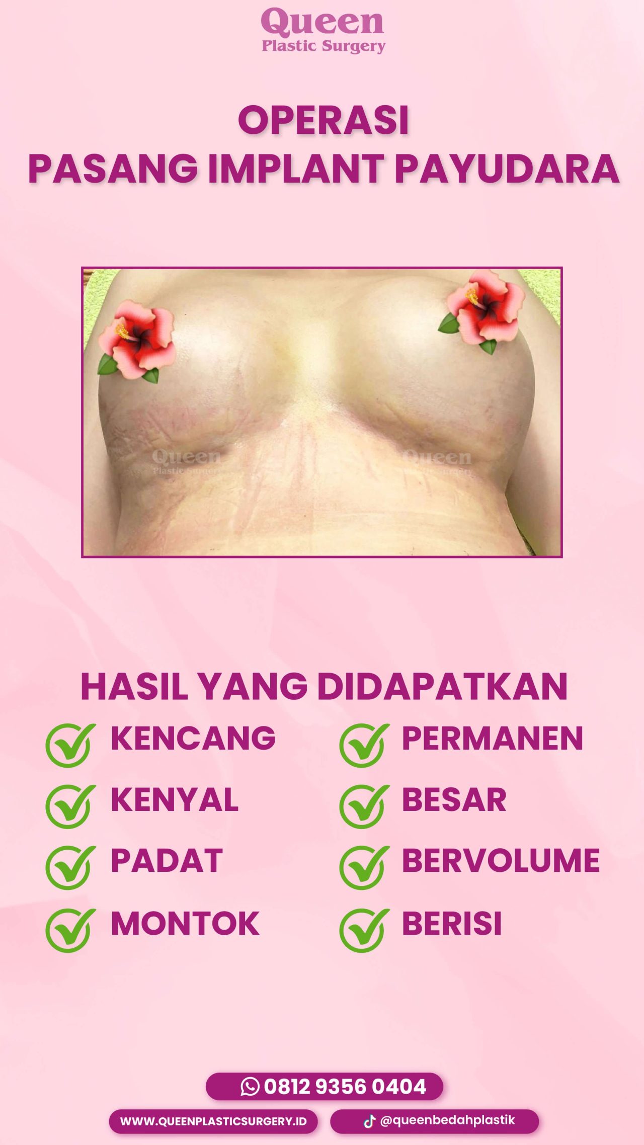 45 IGS