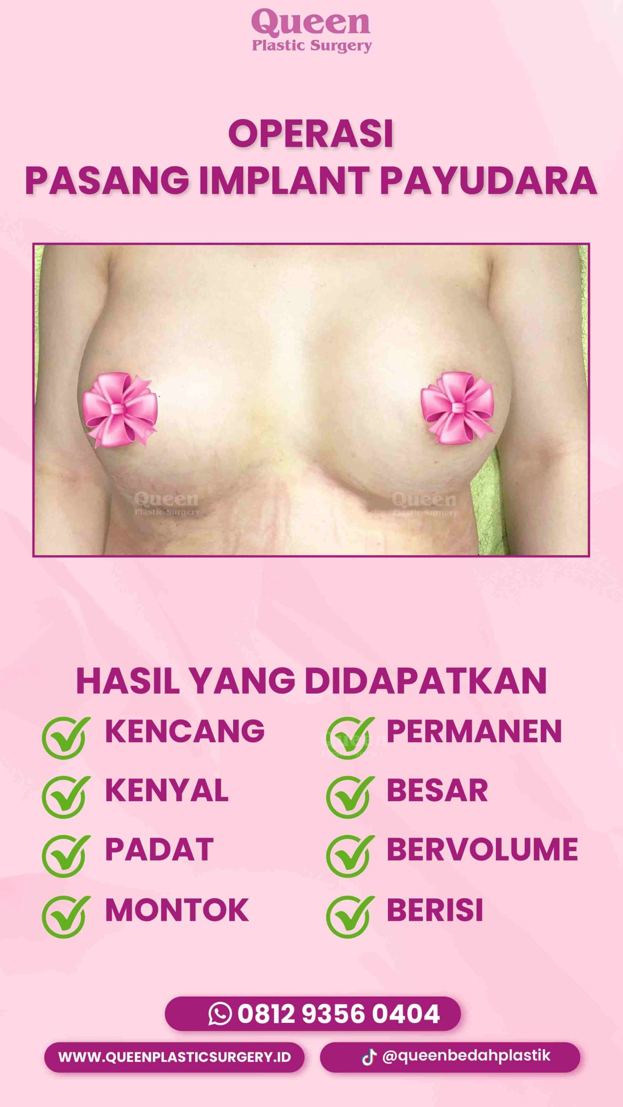 47 IGS -fotor-2024012916326