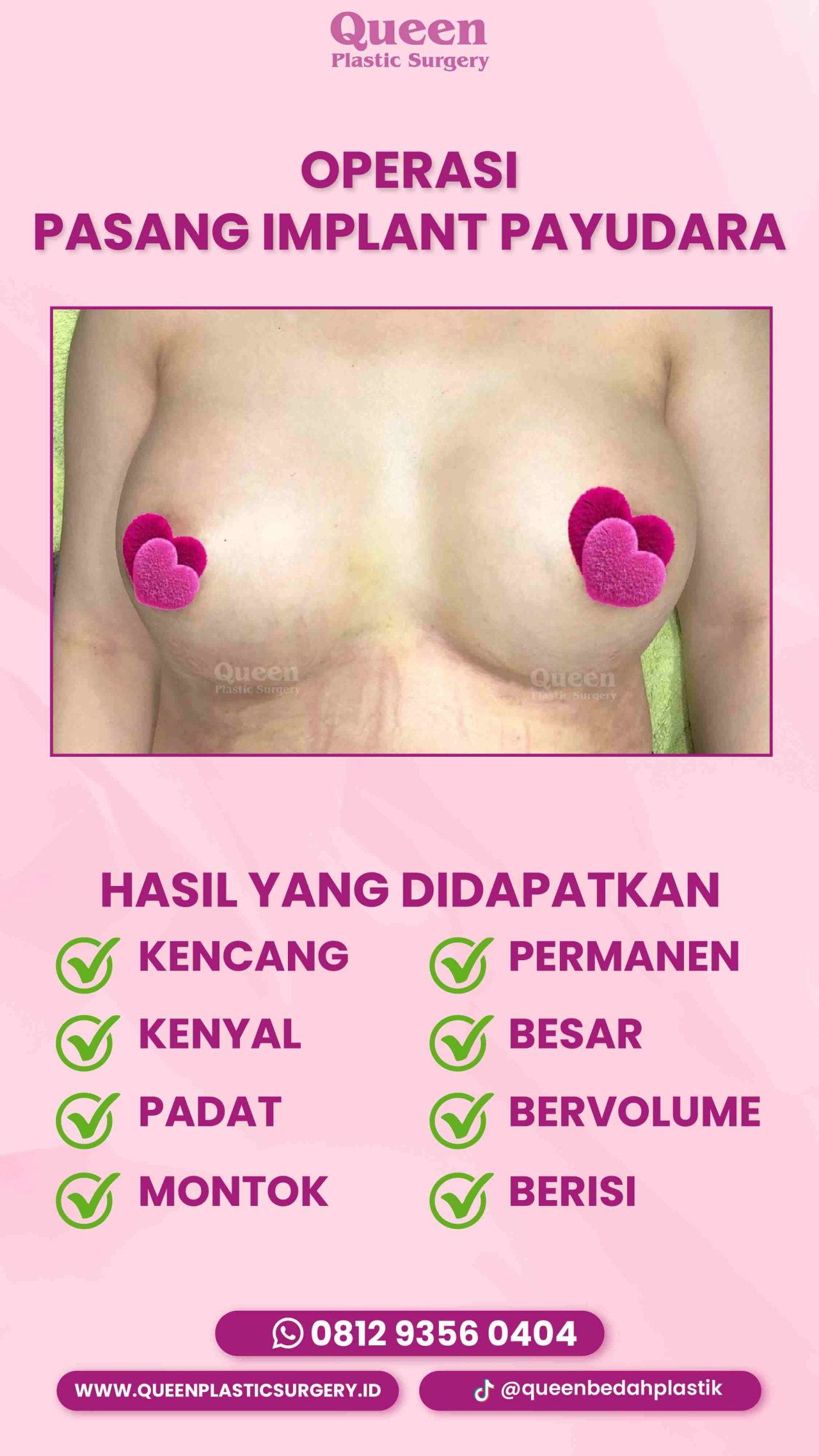 48 IGS -fotor-20240129162940