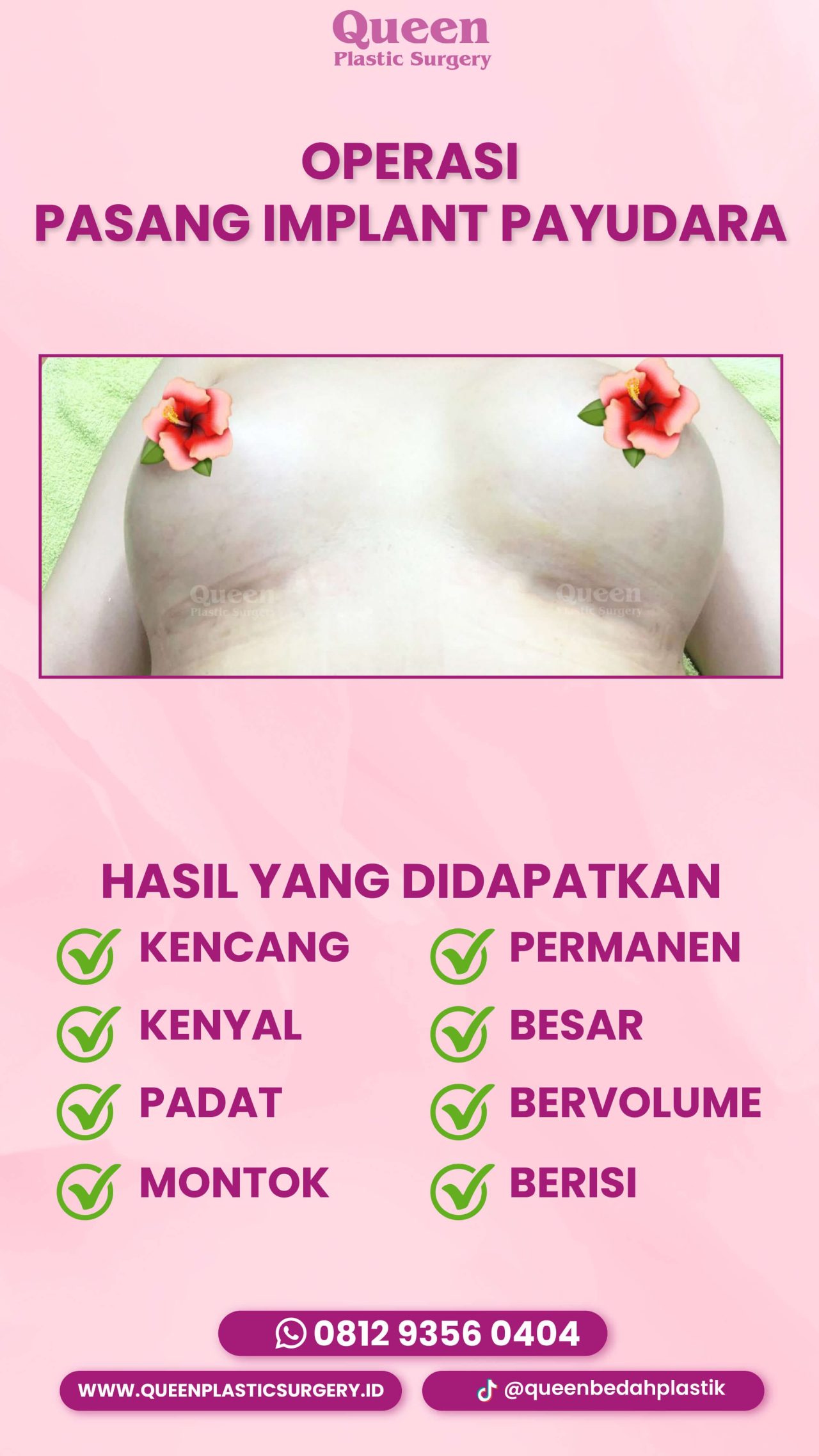 49 IGS
