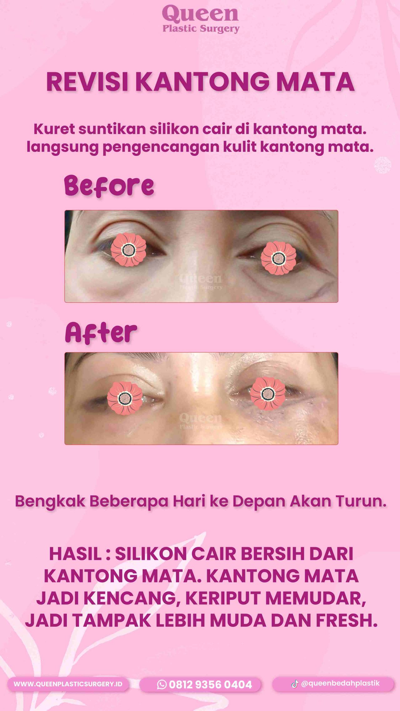 50 IGS-fotor-20240130112211