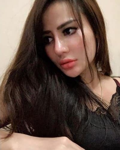 Hasil Rhinoplasty Queen Plastic Surgery, foto 8