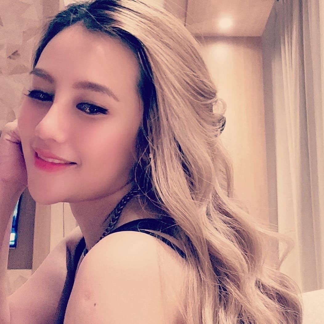 Hasil Rhinoplasty Queen Plastic Surgery, foto 6