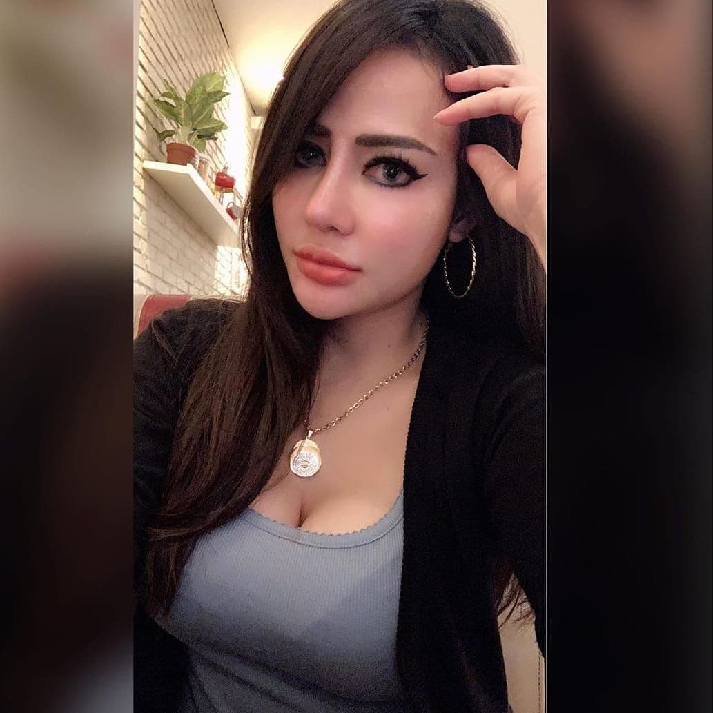 Hasil Rhinoplasty Queen Plastic Surgery, foto 16