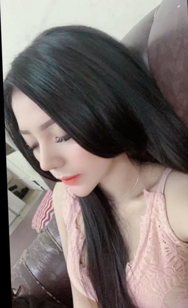 Hasil Rhinoplasty Queen Plastic Surgery, foto 22