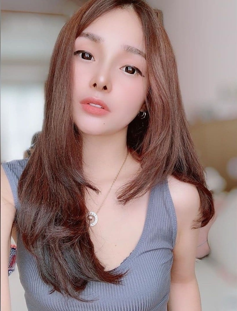 Hasil Rhinoplasty Queen Plastic Surgery, foto 21