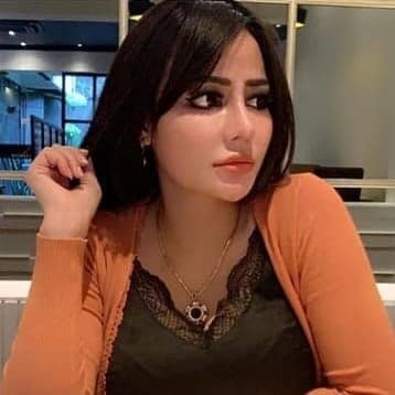 Hasil Rhinoplasty Queen Plastic Surgery, foto 20