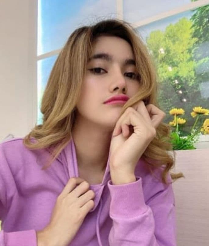 Hasil Rhinoplasty Queen Plastic Surgery, foto 19