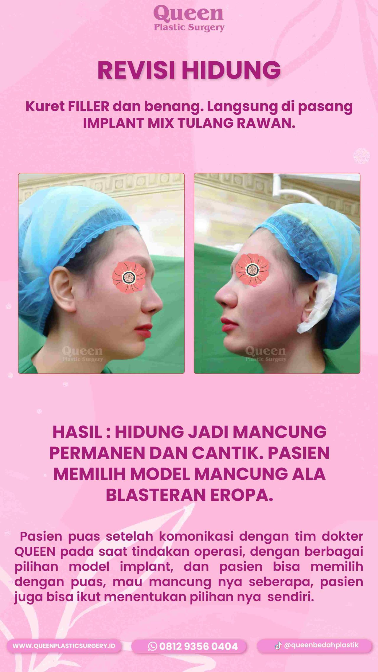 51 IGS-fotor-20240129143439