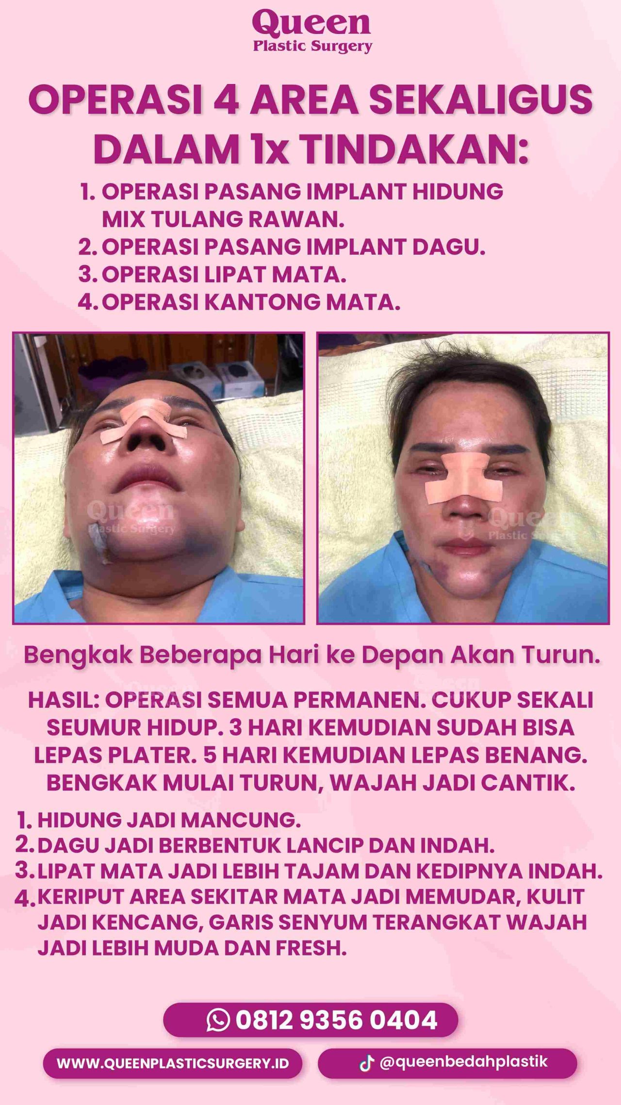 70 IGS-fotor-20240130112411