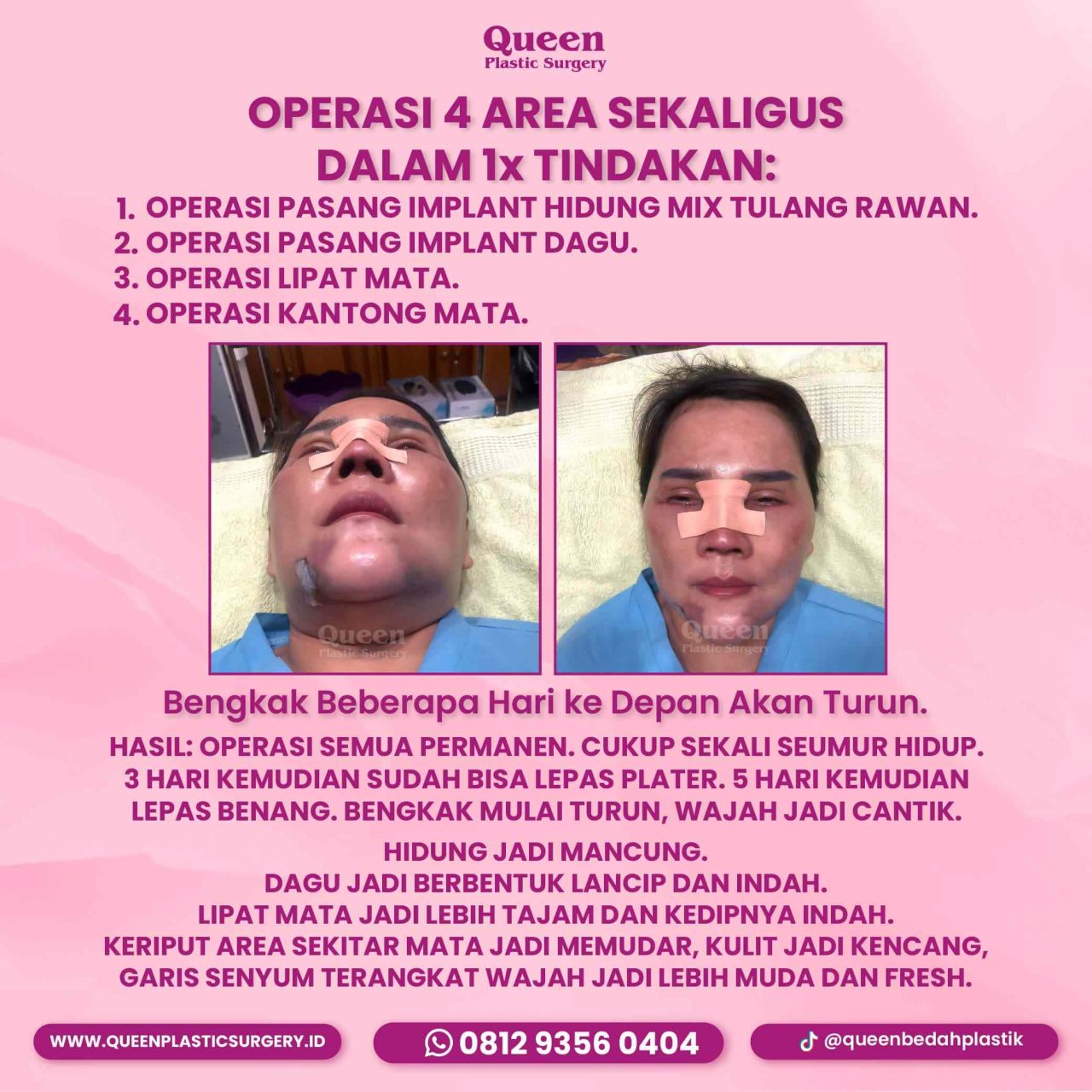 78 IGF -fotor-20240130114521